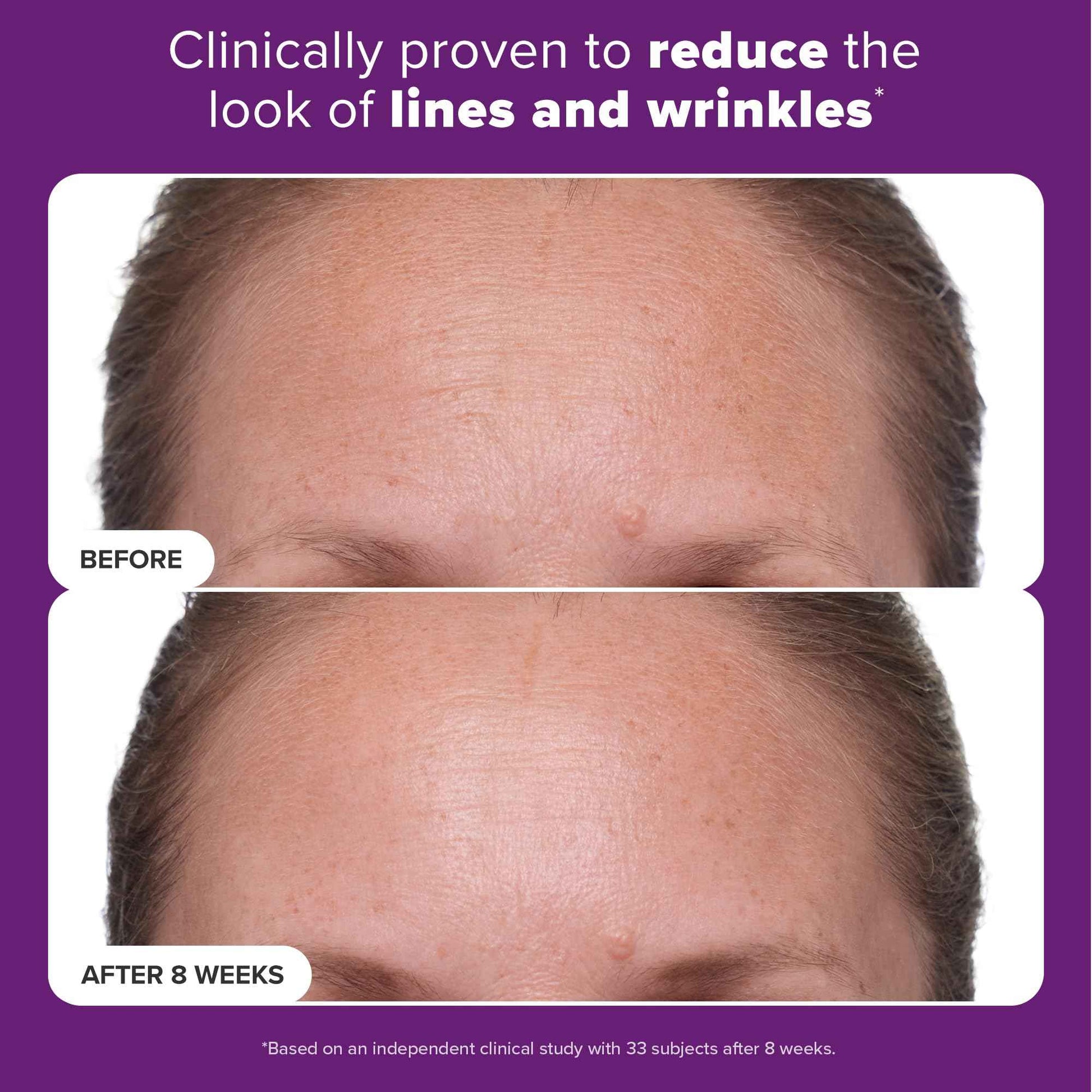 Paula's Choice CLINICAL 1% Retinol Treatment Cream with Peptides, Vitamin C & Licorice Extract, Anti-Aging & Wrinkles, Travel Size. PACKAGING MAY VARY.