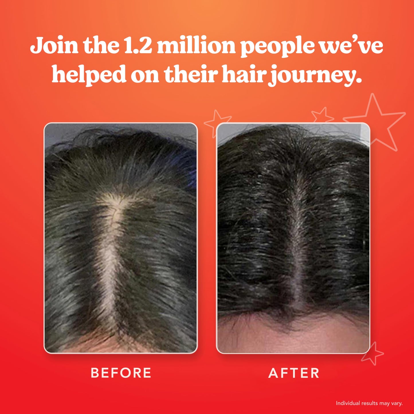 HAIRtamin Scalp Serum Natural Hair Growth Thickening Treatment | Made in USA | Helps Increase Hair Thickness and Aids Against Hair Thinning and Fall Out | Moisturizes and Soothes Dry Itchy Scalp