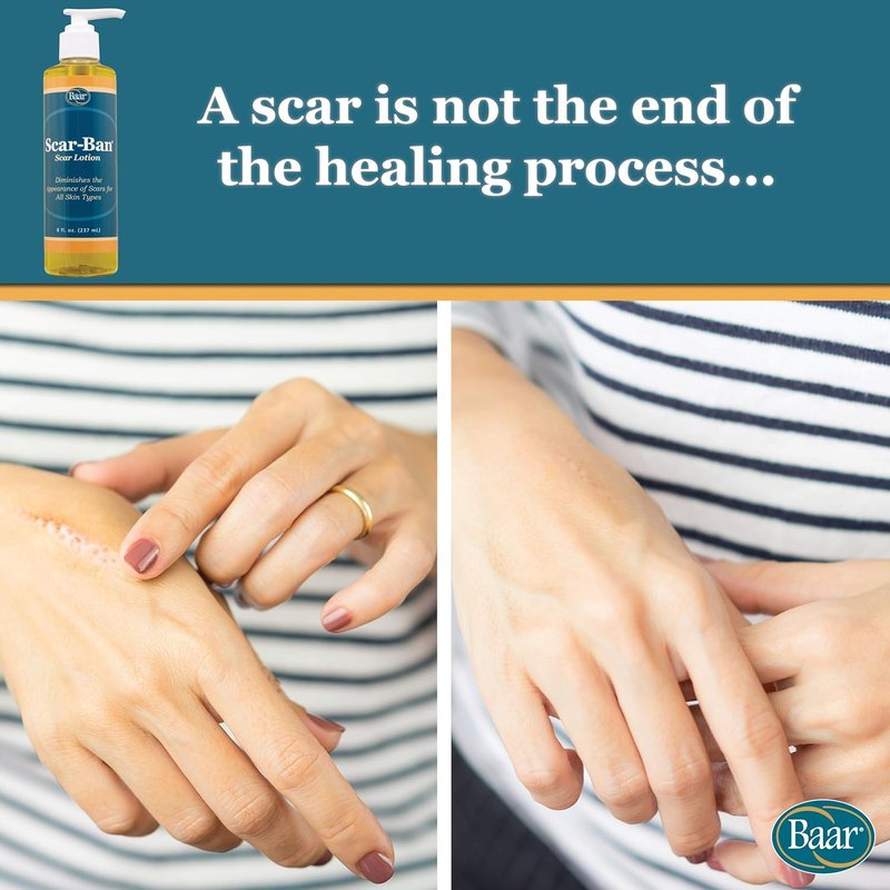 Scar Ban - Effective Scar Treatment Gel | 8 oz Pump for Fast Healing