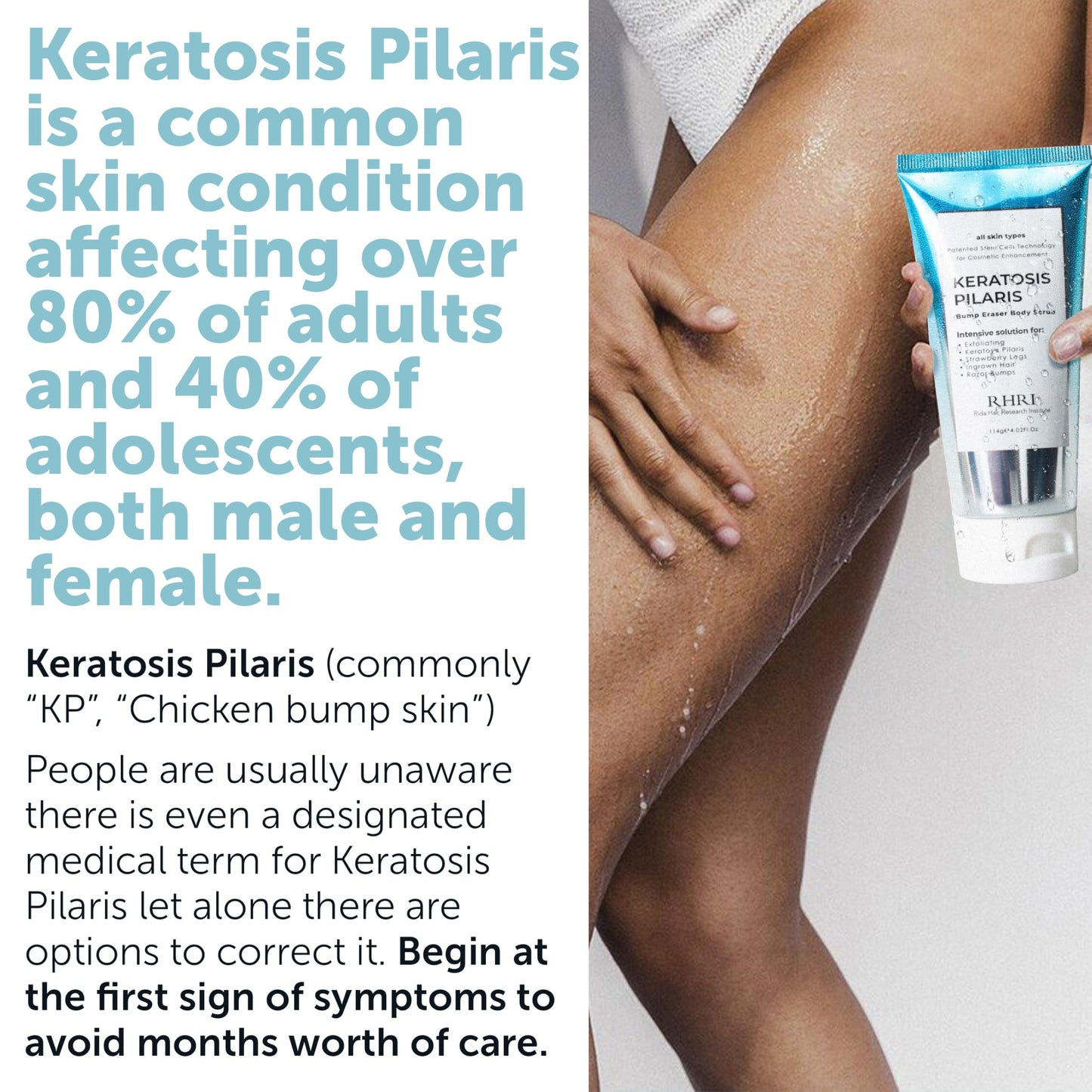 KP Bump Eraser Body Scrub with 10% AHA | Keratosis Pilaris Treatment | Bump Eraser Body Scrub | Clears Strawberry Legs | Soothes Redness, Dryness & Flaky Skin