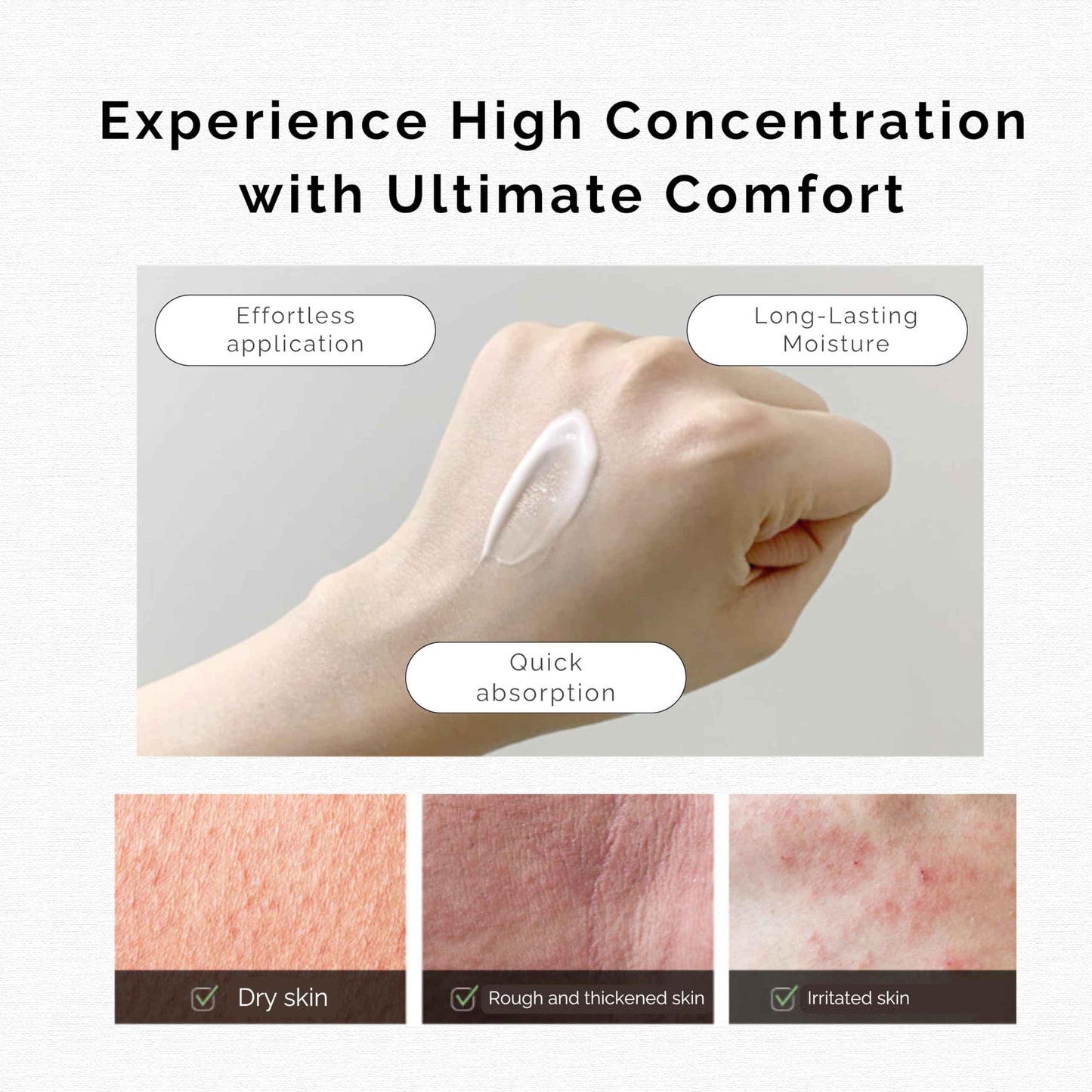 NOSTE SKINCURE Cellike Rapid Soothing Ato Liposome Lotion, Deep Soothing & Skin Barrier Repair for Dry & Itchy Skin, Hypoallergenic, Vegan Lotion, 1.01 fl.oz.