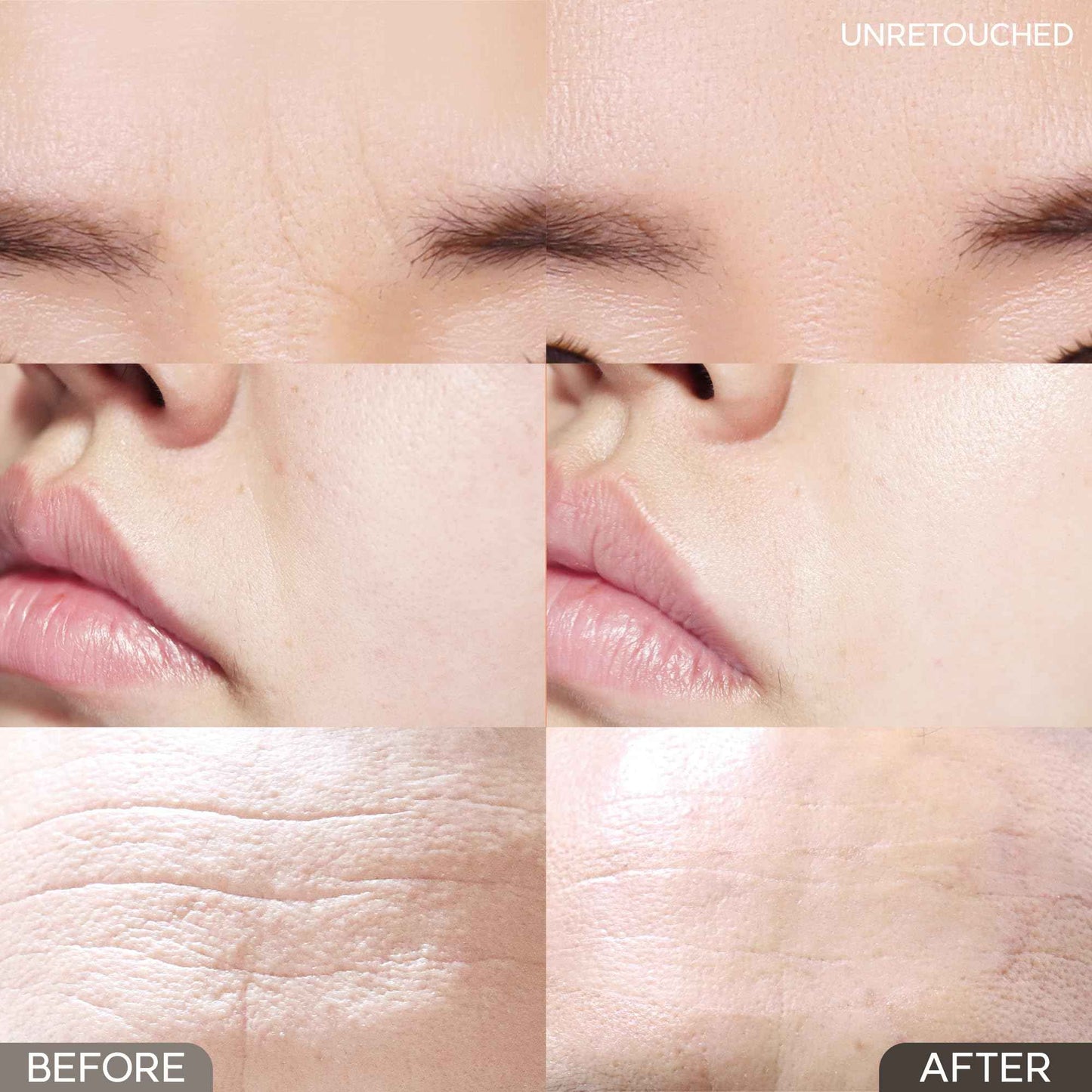 MARSHIQUE Between the Eyes Wrinkle Patches - Gifts for Mom & Dad - Frown Lines Eleven Lines Non invasive Face Wrinkles Smoothers - Tape Tox - Korea Beauty Care, 55 Patches