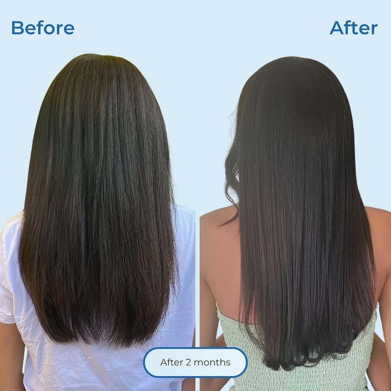 Agua de Cielo Hair Energizing Drops - Biotin & Ginger Growth Oil for Nourishing Hair Follicles | 4 Oz