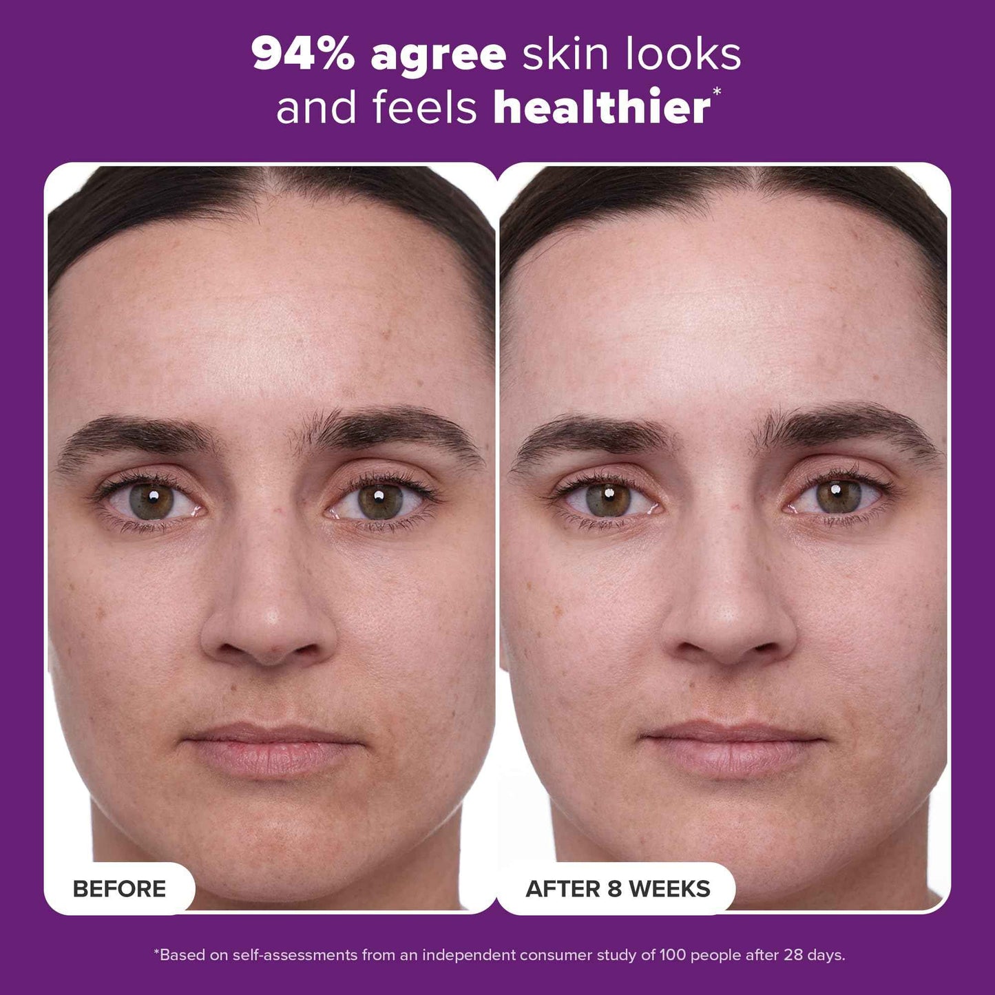 Paula's Choice CLINICAL 1% Retinol Treatment Cream with Peptides, Vitamin C & Licorice Extract, Anti-Aging & Wrinkles, Travel Size. PACKAGING MAY VARY.