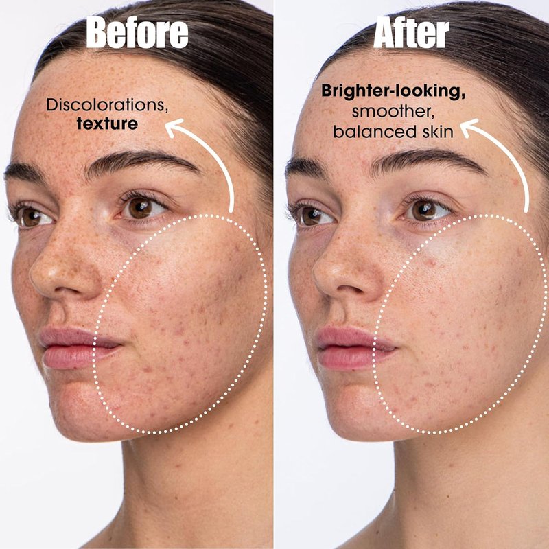 Detox Darling Balancing Essence Mist - Oily & Blemish-Prone Skin Care | Hydrating Formula