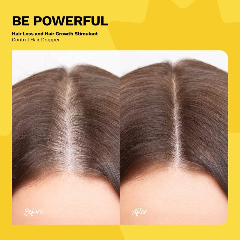 Ginger Milk Natural Care Ginger Root Extract | Hair Growth Serum & Growth Stimulating Hair Drops for Hair Loss Control | Vegan Energizing Hair Elixir with Rosemary & Biotin | Be Powerful (4 fl oz)