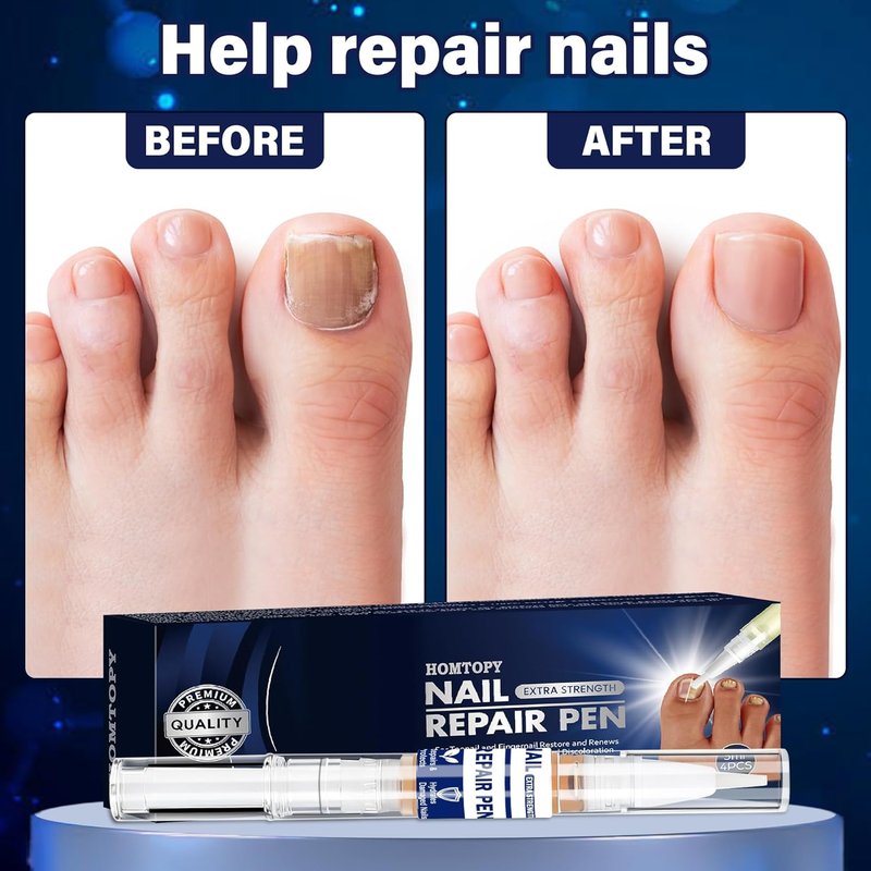Toenail Repair Pen - Extra Strength Formula for Athlete’s Foot & Jock Itch | 4-Pack
