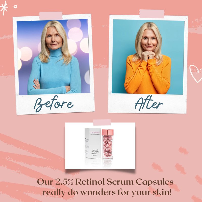 Turbinne Pure 2.5% Retinol Serum Capsules. Look 5 Years Younger In 30 Days. Powerful Anti -Aging, Deep Hydration, Brightening, Reduce Acne, Dark Spots & Wrinkles (Pack of 4)