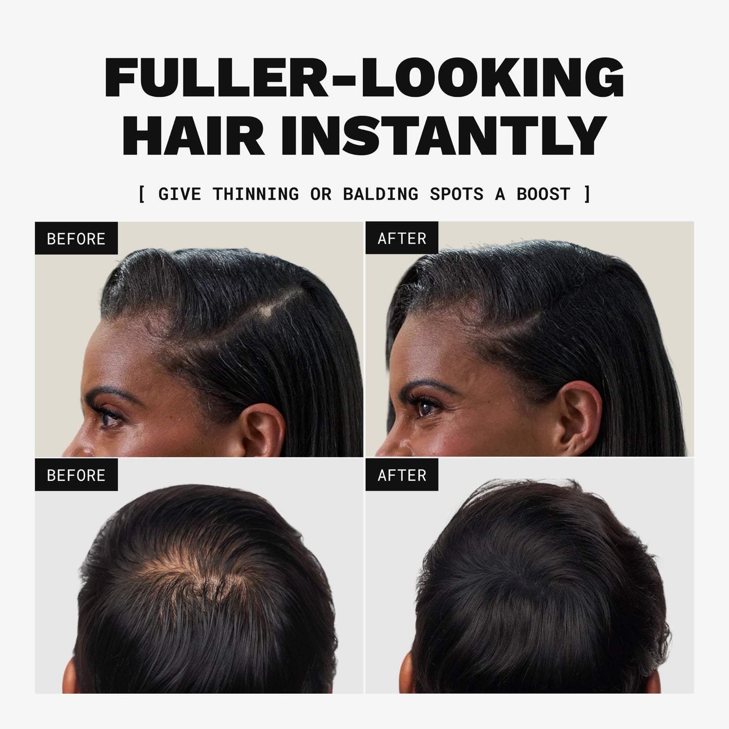 Toppik Hair Building Fibers, White, 27.5g, Fill In Fine or Thinning Hair, Instantly Thicker, Fuller Looking, 9 Shades for Men & Women, Keratin Protein Formula