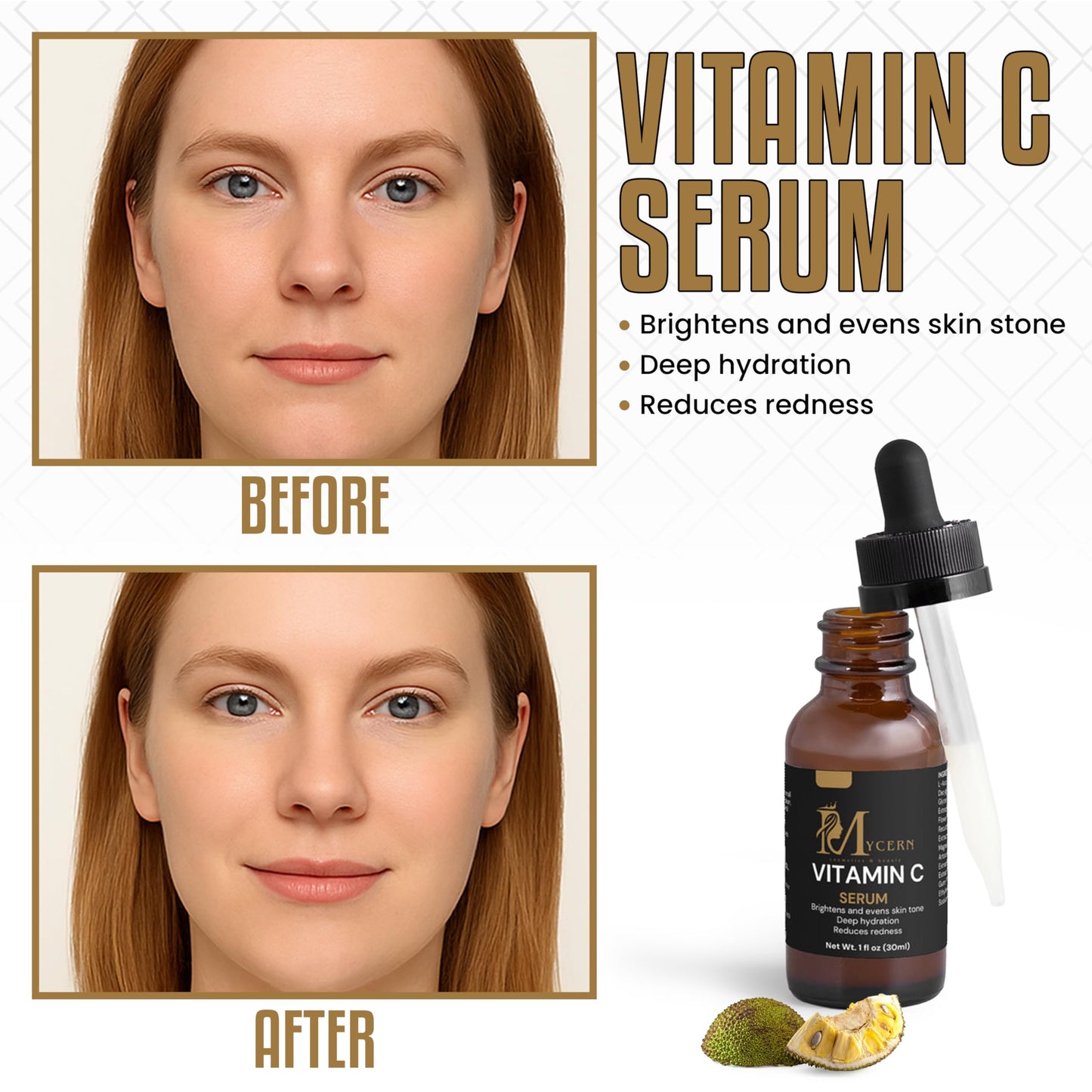 MyCern Vitamin C Serum for Face – Brightening & Hydrating Face Serum, Non-Greasy, with L-Ascorbic Acid & Ferulic Acid, Antioxidant Skin Care for Radiant, Smooth Skin, 1 fl oz