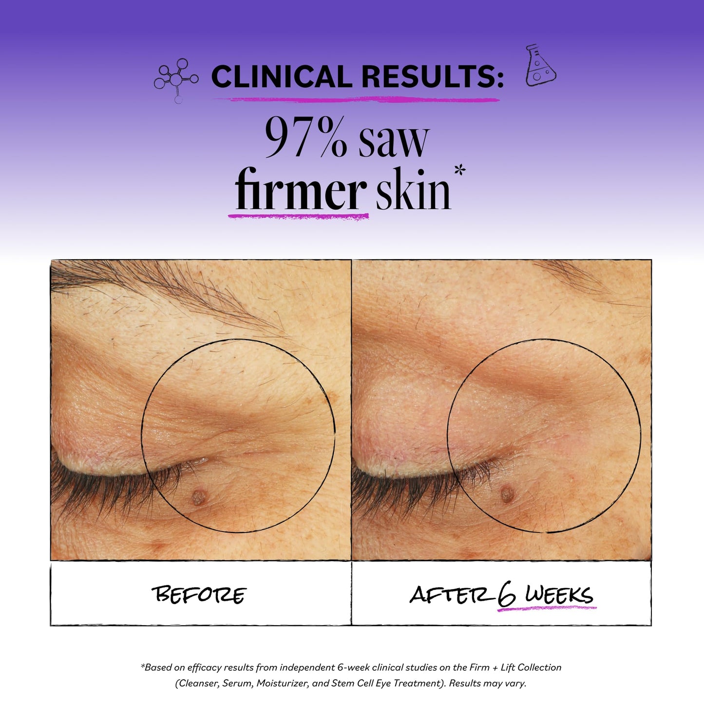 Derma E Stem Cell Lifting Eye Treatment – Multi Action Firming and Tightening Under Eye and Upper Eyelid Cream - Hydrating and Revitalizing Moisturizer, 0.5oz
