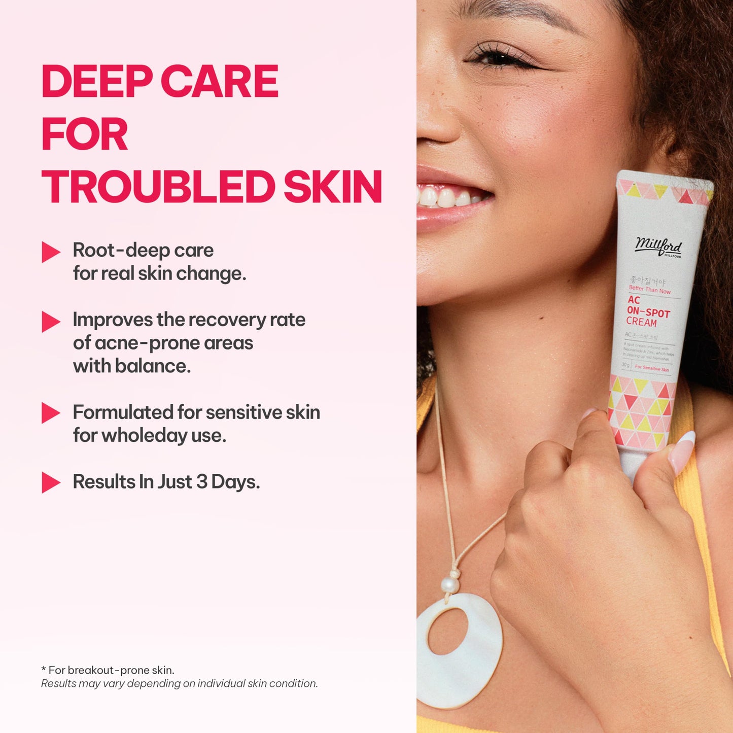 Millford AC On-Spot Cream 30g/1.05 Oz, Zinc Oxide 10%, Niacinamide 2% for Active Skin Repair, Acne Spot Treatment for Face, Blemish Care, Dark Spot, Korean Skincare for Sensitive & Acne-Prone Skin