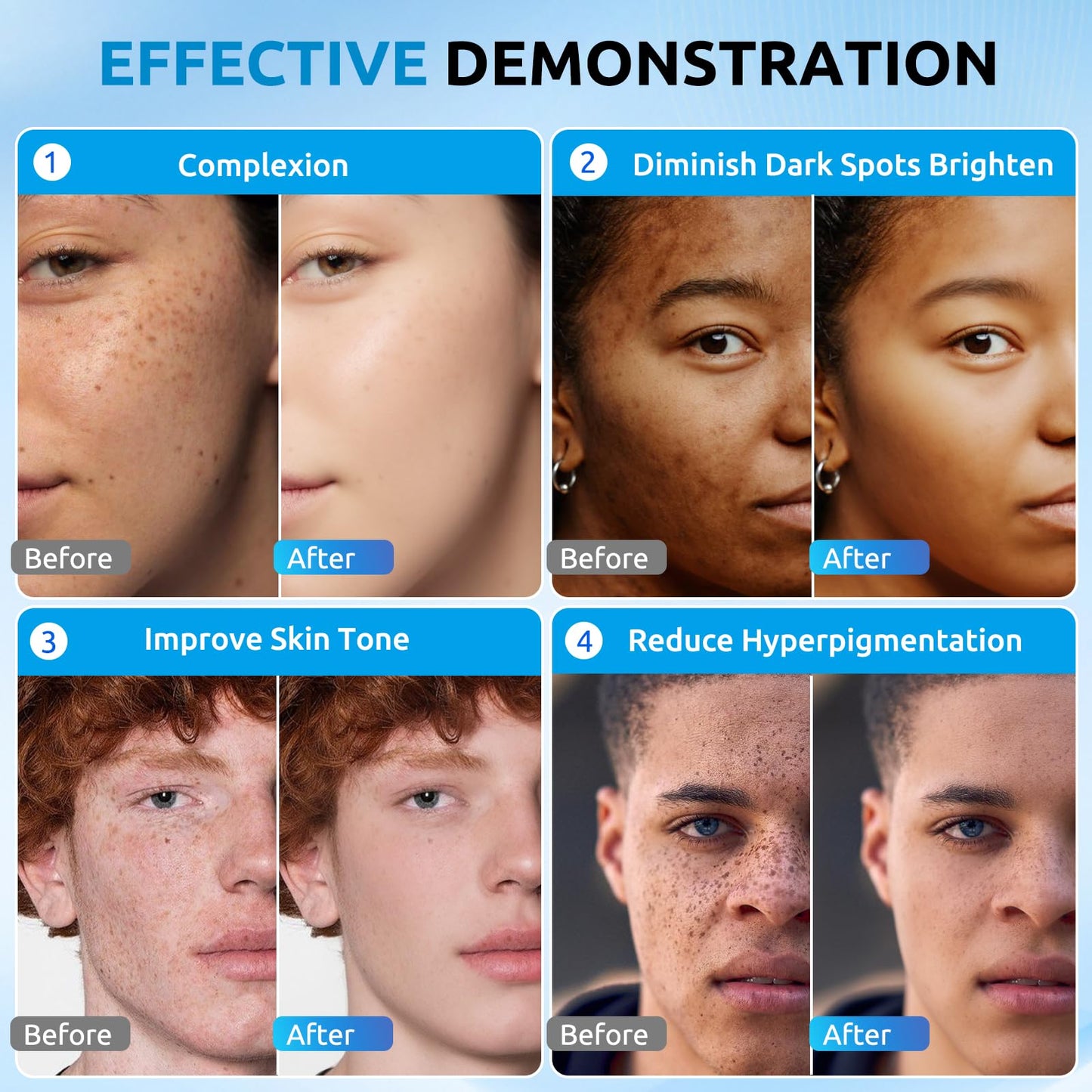 HANYWIL Dark Spot Remover for Face & Body Serum,Dark Spot Corrector Serum for Hyperpigmentation,Treatment for Sun Spots, Age Spots, Melasma, Dermatologist-Tested Skin Tone Evenser (2.0 Fl Oz)
