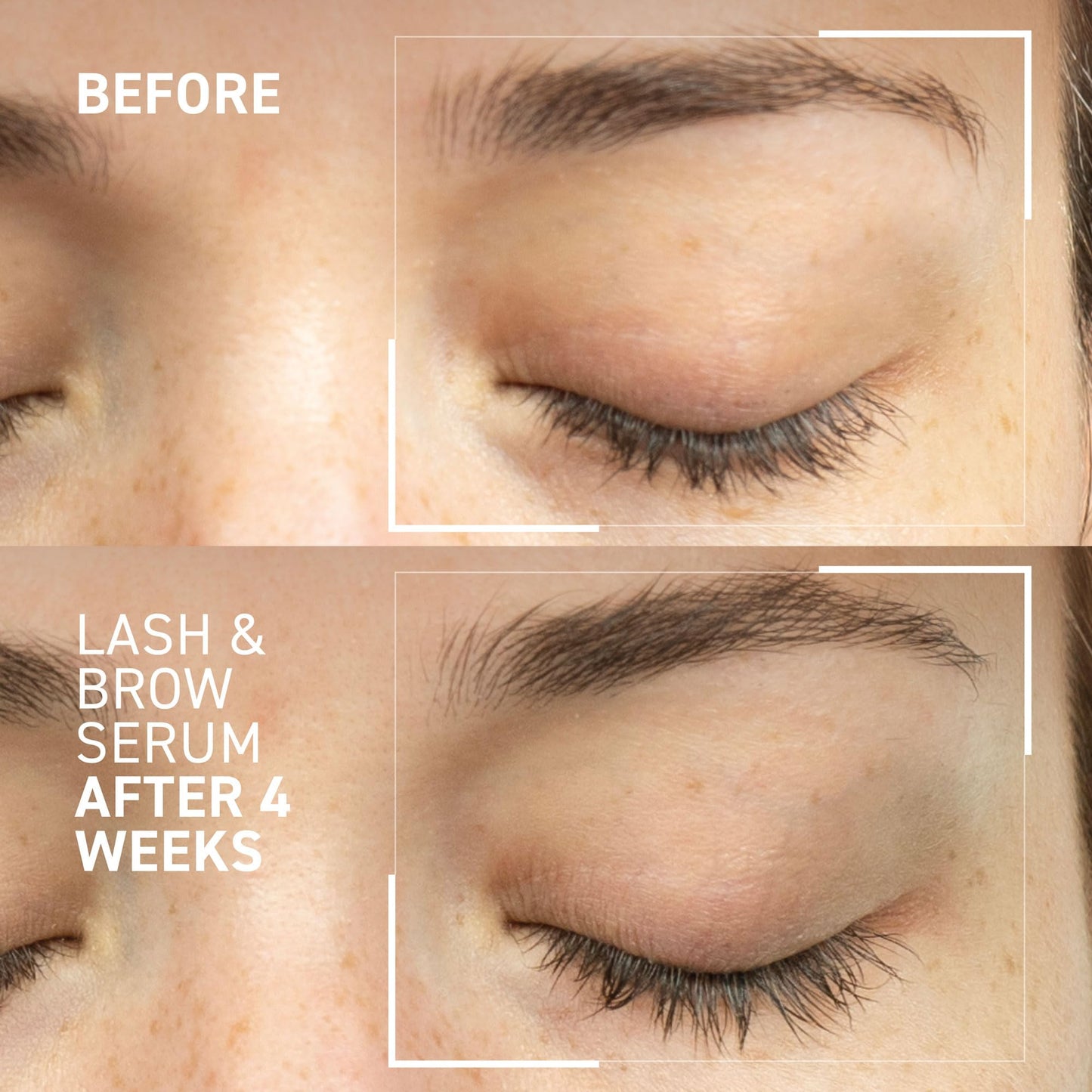 Dr. Brandt Dr. B Lab Lash & Brow Serum - Growth & Conditioning Formula for Longer, Fuller Hair Follicles - 0.17 fl oz