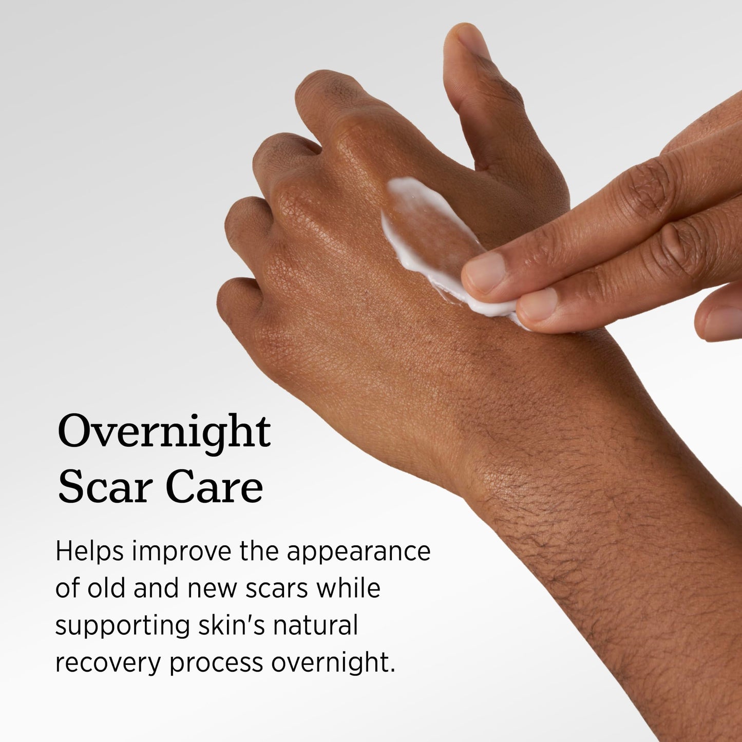 NUVADERMIS Overnight Intensive Scar Cream with Retinol, Allantoin, Vitamin E, Betaine – 1.35 Fl Oz PM Scar Cream Treatment for C-Sections, Keloids & Post-Surgery Care