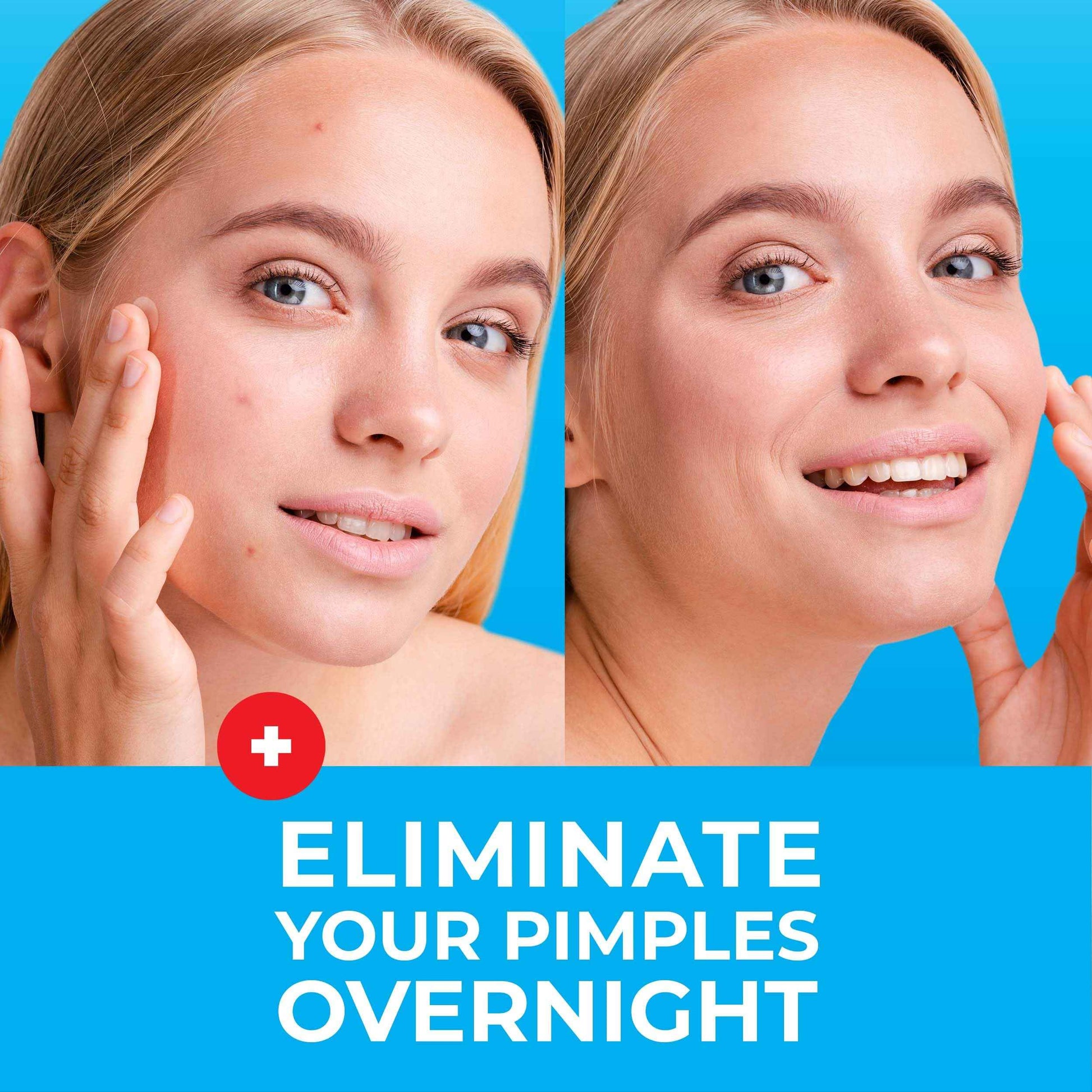 KEYCONCEPTS PatchRx Pimple Patches Bundle - + Pimple Stickers for Face + Large Pimple Patches