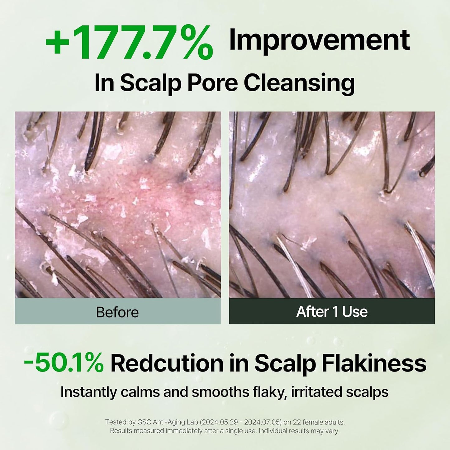 Algae Therapy Seaweed Shampoo for Thinning Hair - Marine PDRN & Biotin | Hair Thickening & Scalp Strengthening | 16.9 Fl Oz