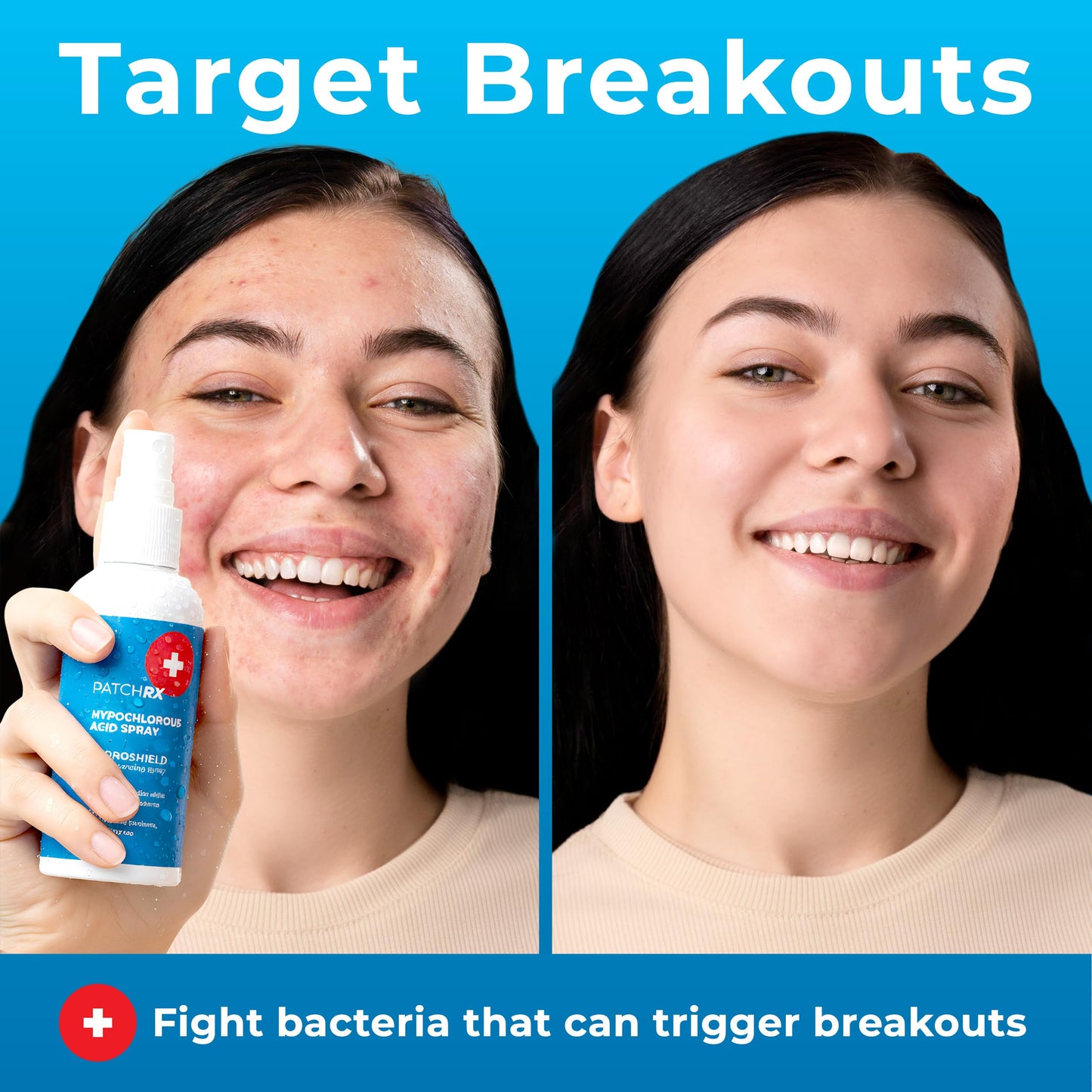 PatchRx Hypochlorous Acid Spray for Face (8oz, Reduces Acne), Targets Bacteria - HOCL Facial Cleanser Acne Spray for Face, Body, Eczema, Pimples, Breakouts & Overall Skin Recovery (Reduces Redness)