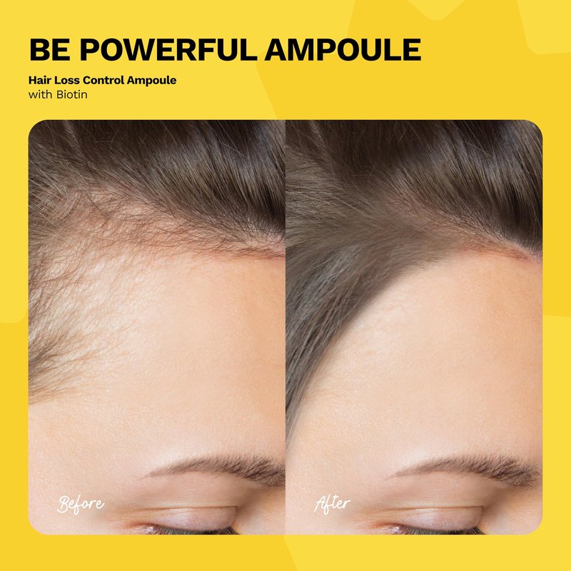 Ginger Milk Ampoule for Hair Loss Control with Biotin | Revitalizing Hair Treatment | BE POWERFUL (Pack 6 x 0.5 fl oz)