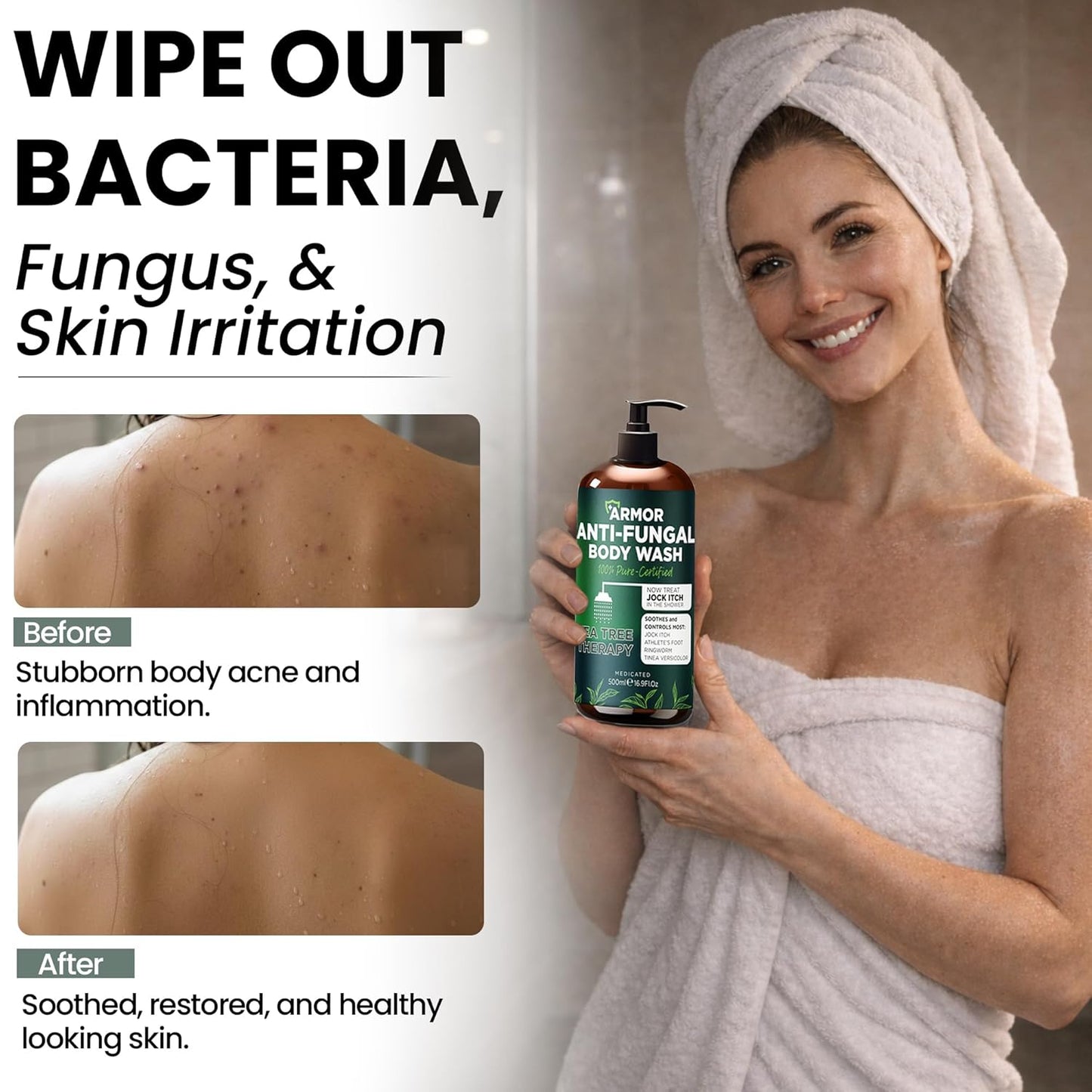 Antifungal Body Wash with Tea Tree Oil - Treat Back Acne, Ringworm & Eczema | Includes Silicone Scrubber (16.9 oz)