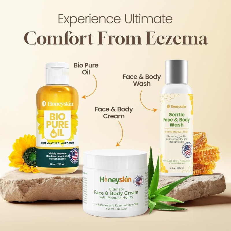 Hydrating Face Moisturizer & Body Cream - Organic Manuka Honey for Dry, Itchy Skin | 4oz