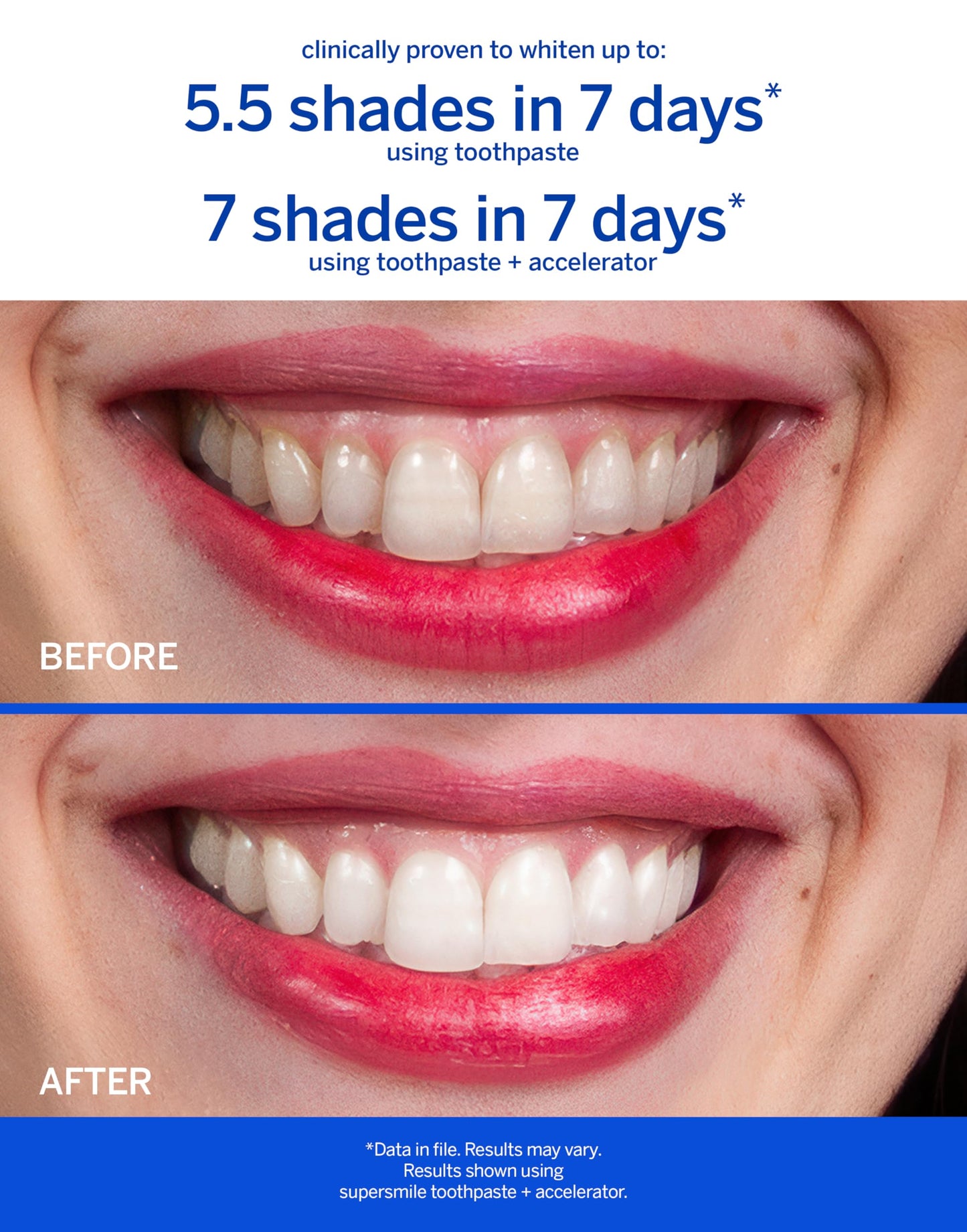 Supersmile Icy Mint Fluoride-Free – Whitening Toothpaste for Visibly Brighter Teeth – Whitens Up to 6 Shades, 8 oz