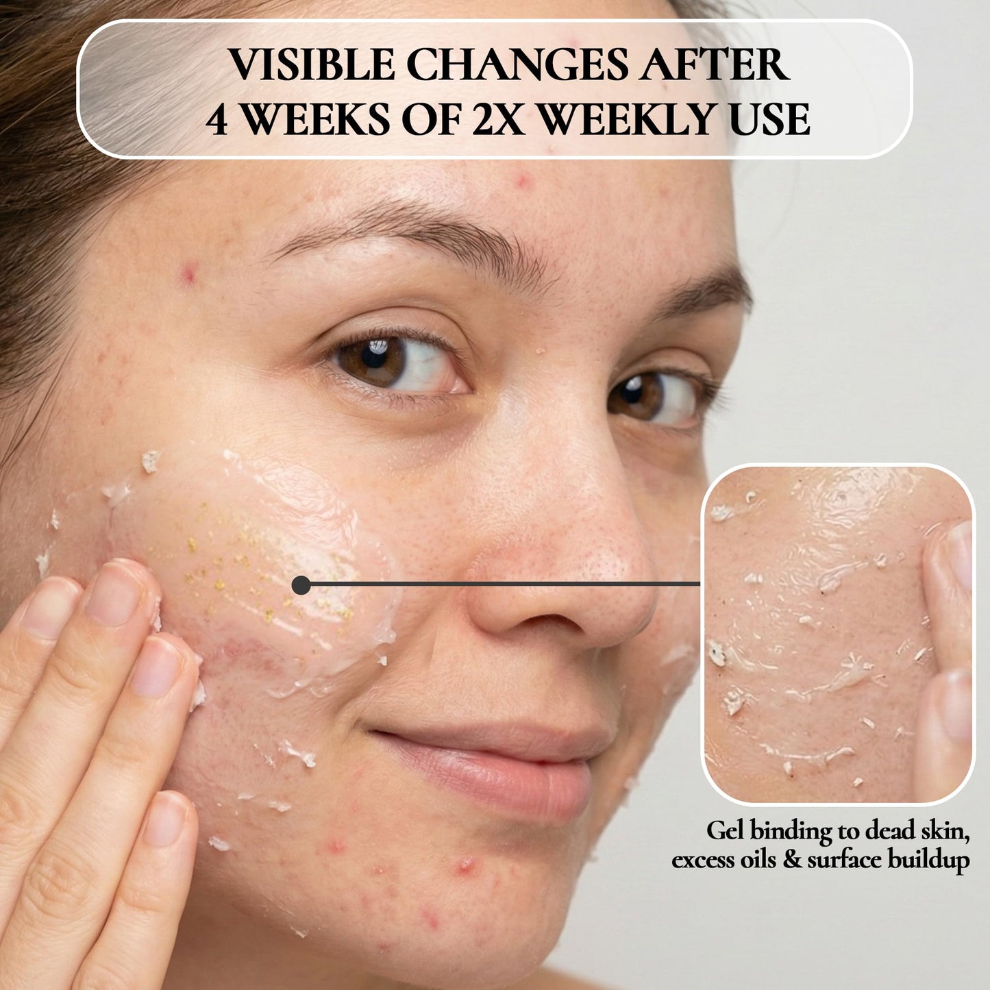 Vivo Per Lei Facial Peeling Gel - Helps Address Dead Skin Buildup - Gentle Exfoliating Gel for Rough, Dry, Sensitive or Mature Skin - Face and Body Scrub - Non Abrasive - 4.05 Fl. Oz.