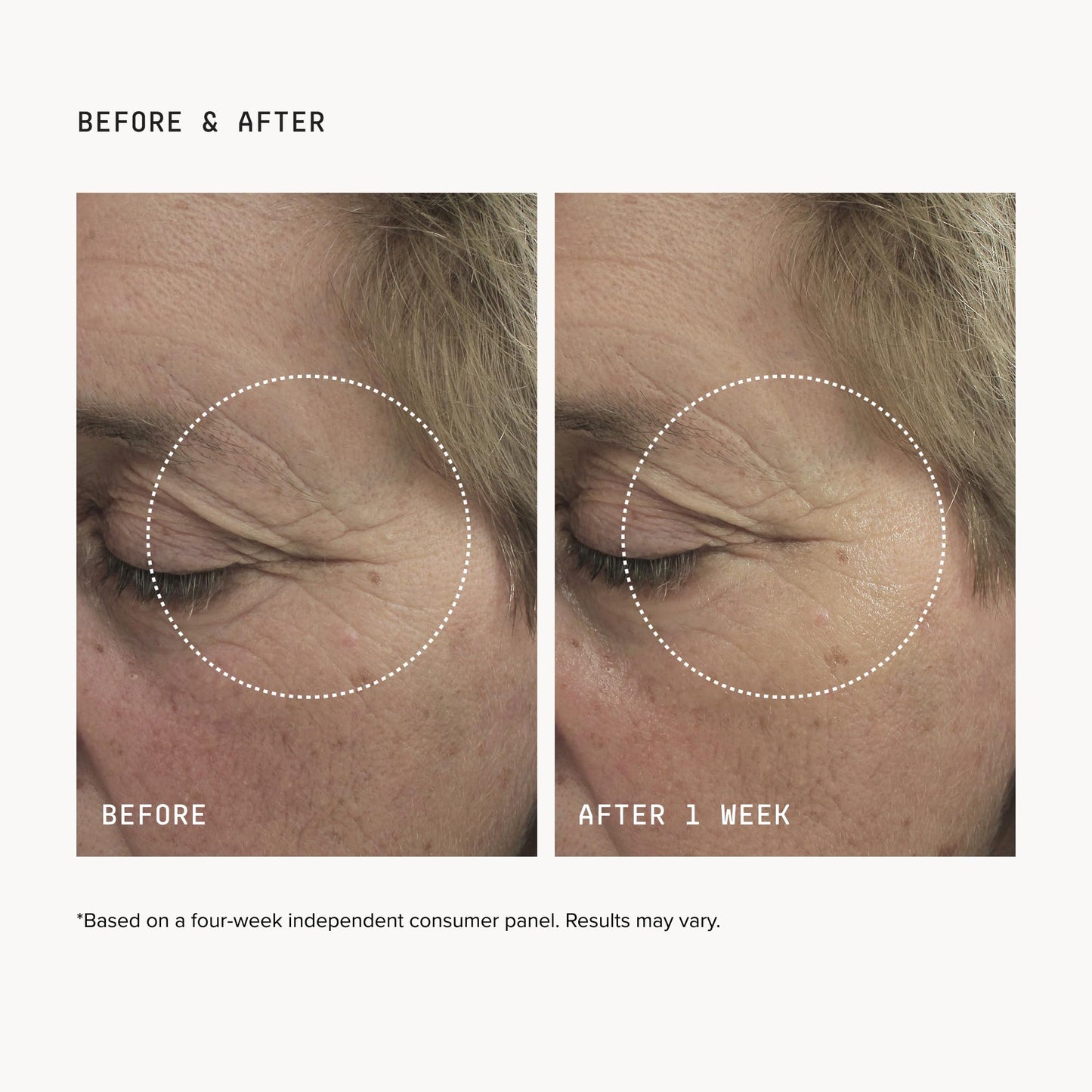 DRMTLGY Brightening Eye Masks – Biodegradable Hydrogel Under Eye Patches with Caffeine, Peptides, Hyaluronic Acid & Niacinamide – Depuff, Hydrate & Smooth Dark Circles