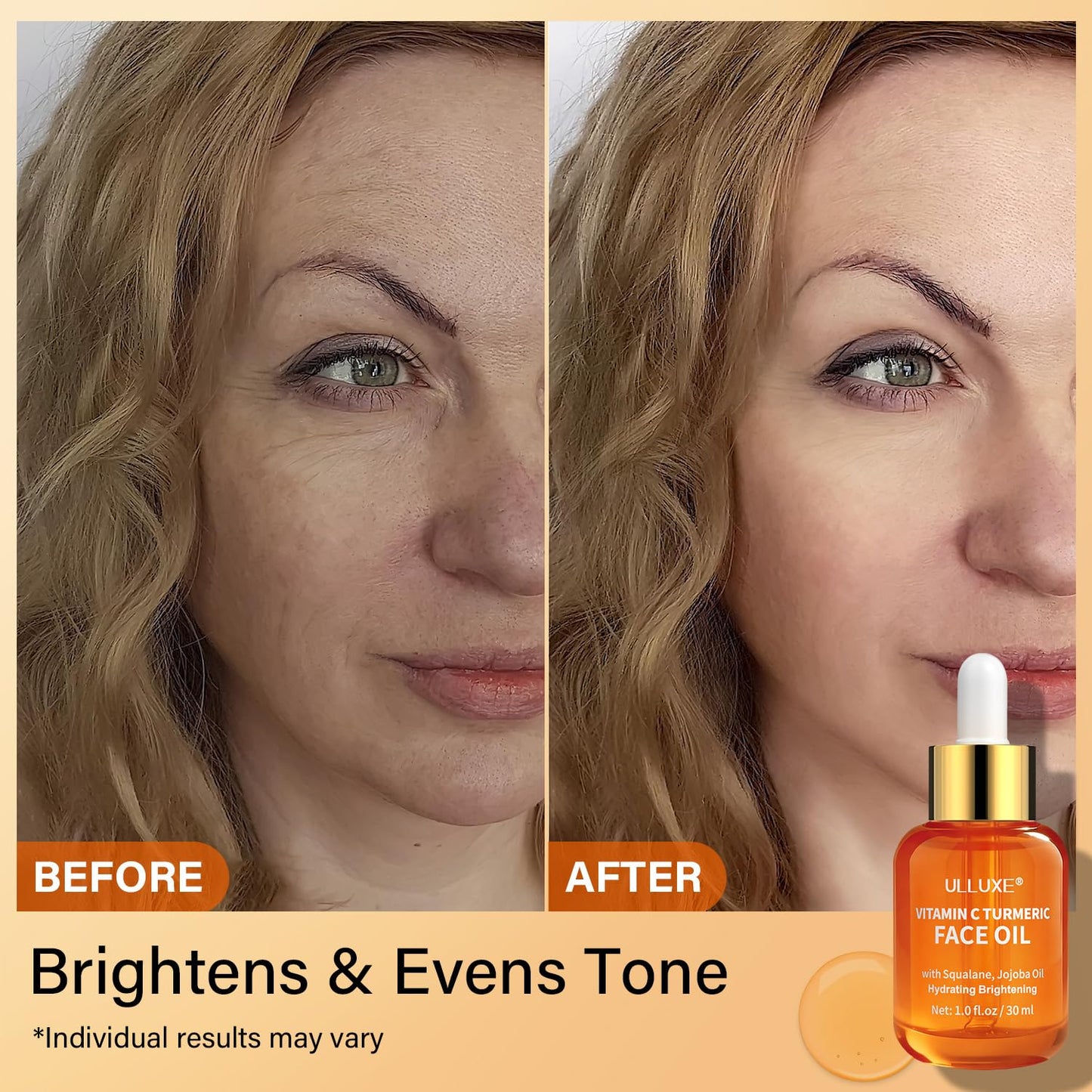 Vitamin C Turmeric Face Oil, Brightening & Hydrating Facial Oil, Nourishing & Anti-Aging with Jojoba Oil & Squalane for Dark Spots, Dry Skin, Wrinkles & Uneven Skin Tone, for All Skin Types, 1 Fl Oz