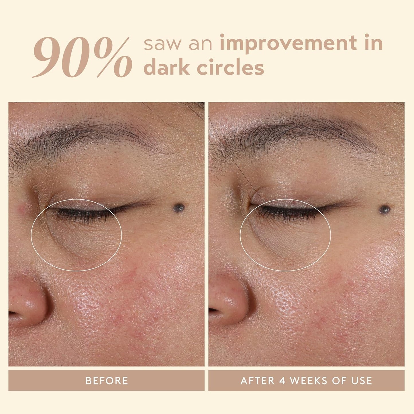 Intensive Eye Renewal Cream - Hydrating Under Eye Treatment for Dark Circles & Fine Lines | Niacinamide & Shea Butter, 0.50 fl oz