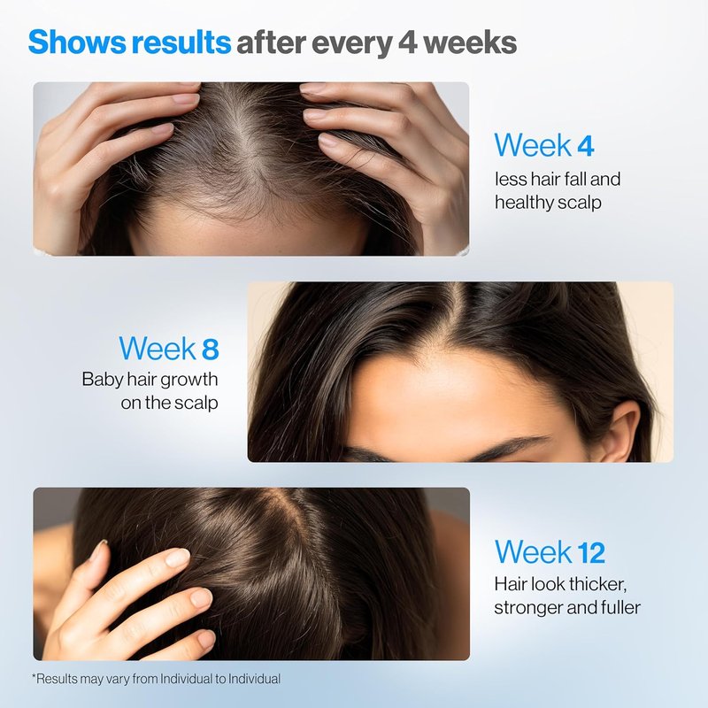Rosemary Hair Growth Serum Roll-On - DHT-Blocking Scalp Treatment | 50 ml with 3% Rosemary, 3% Redensyl, 2% Anagain | Paraben/Sulfate-Free for Men & Women