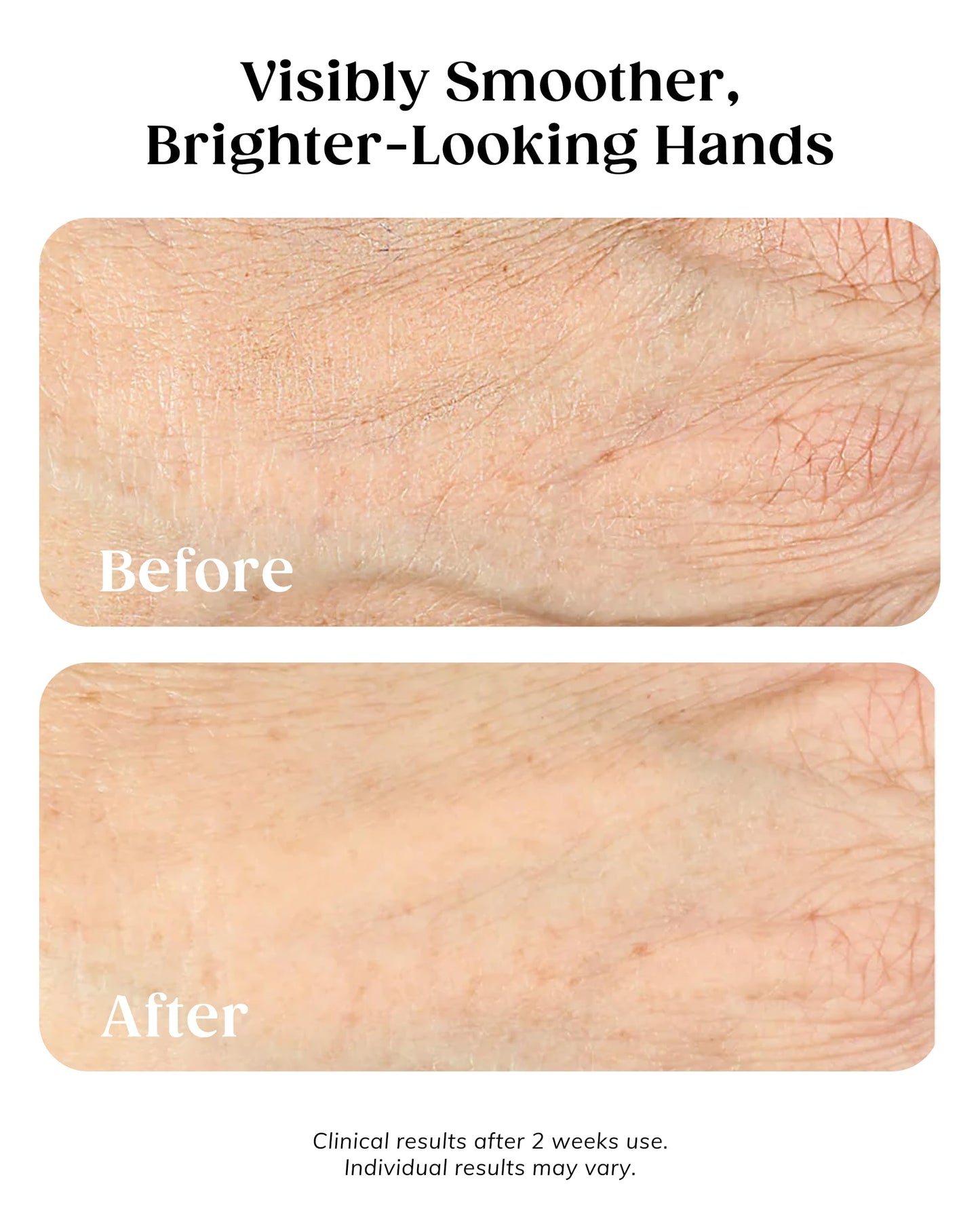 KAPLAN MD Anti Aging Hand Cream Treatment - 5 Essential Moisturizers Diamond Contour Intensive Hand Cream for Women with Vitamin C, Crushed Diamonds & Argireline - Dermatologist-Developed