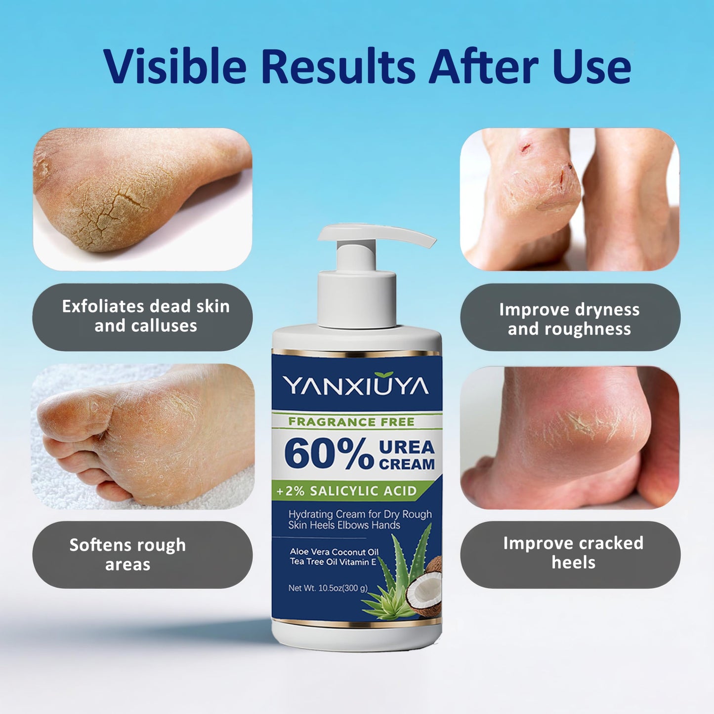 YANXIUYA 60% Urea Cream 10.5 oz, Fragrance-Free Body Lotion with 2% Salicylic Acid, Foot Cream and for Feet, Cracked Heels, Dry Skin & Callus Remover, Maximum Strength Moisturizing Cream