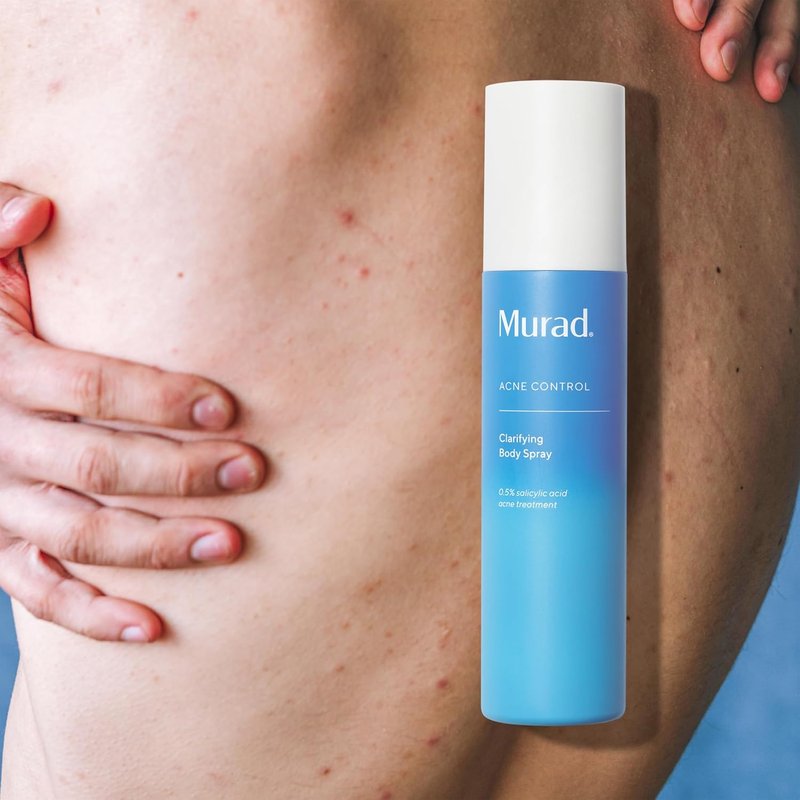 Murad Clarifying Body Spray - Salicylic Acid Treatment for Bacne | Prevent Body Acne Breakouts on Back, Shoulders & Arms