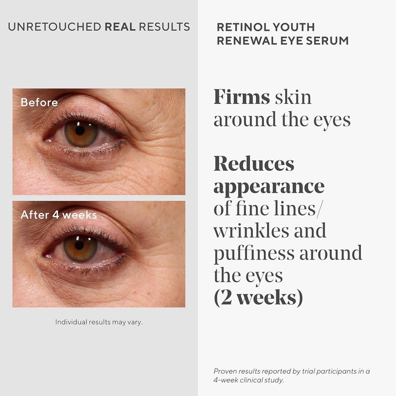 Murad Retinol Youth Renewal Eye Serum - Reduce Dark Circles & Puffiness | Gentle Nightly Formula - 0.5 oz