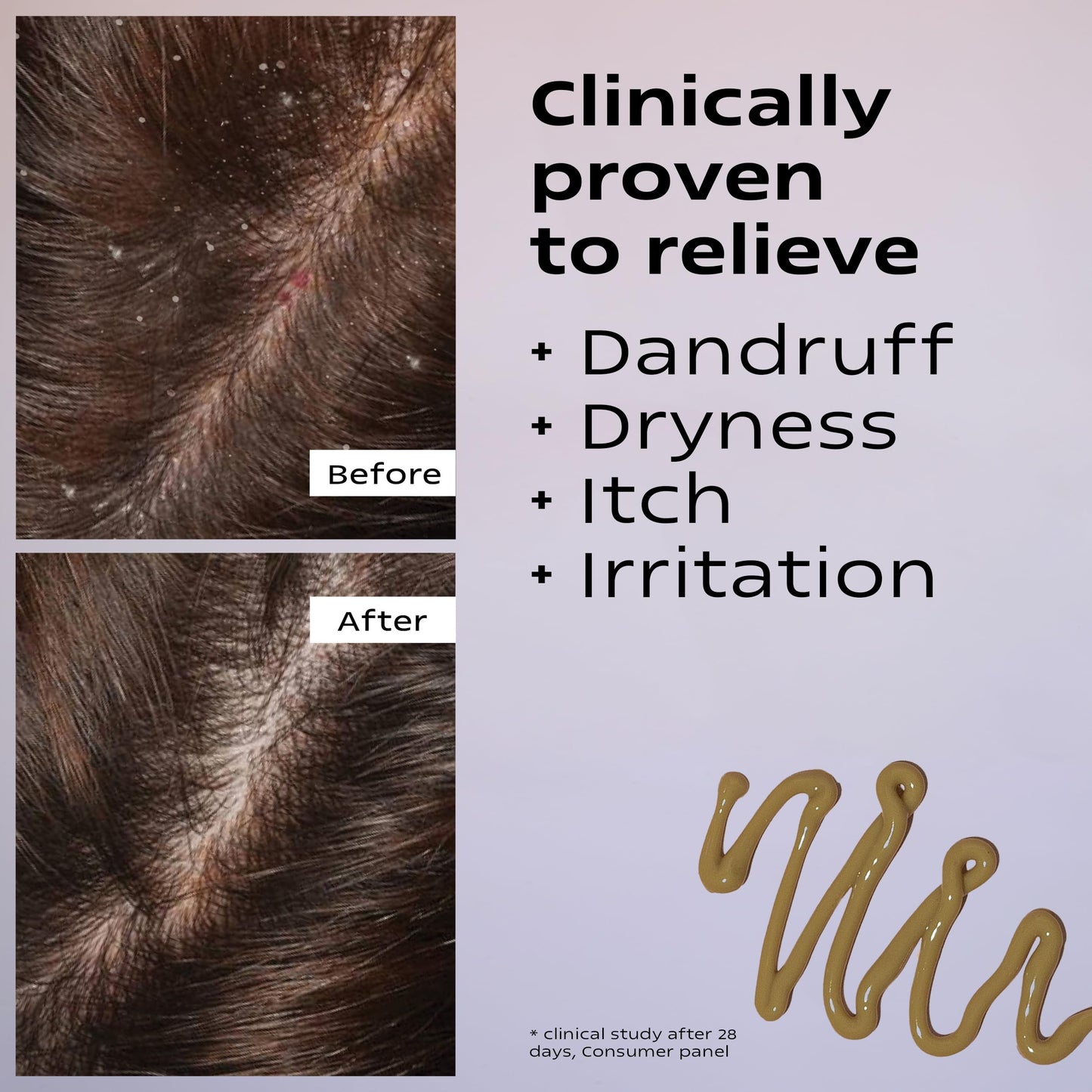 KAMEDIS Scalp Moisturizer Lotion For Dry, Itchy, Dandruff, Flaky & Sensitive Scalp. Over-Night Mask Treatment Botanicals-Based. Parabens Free. 3.38 Fl Oz.