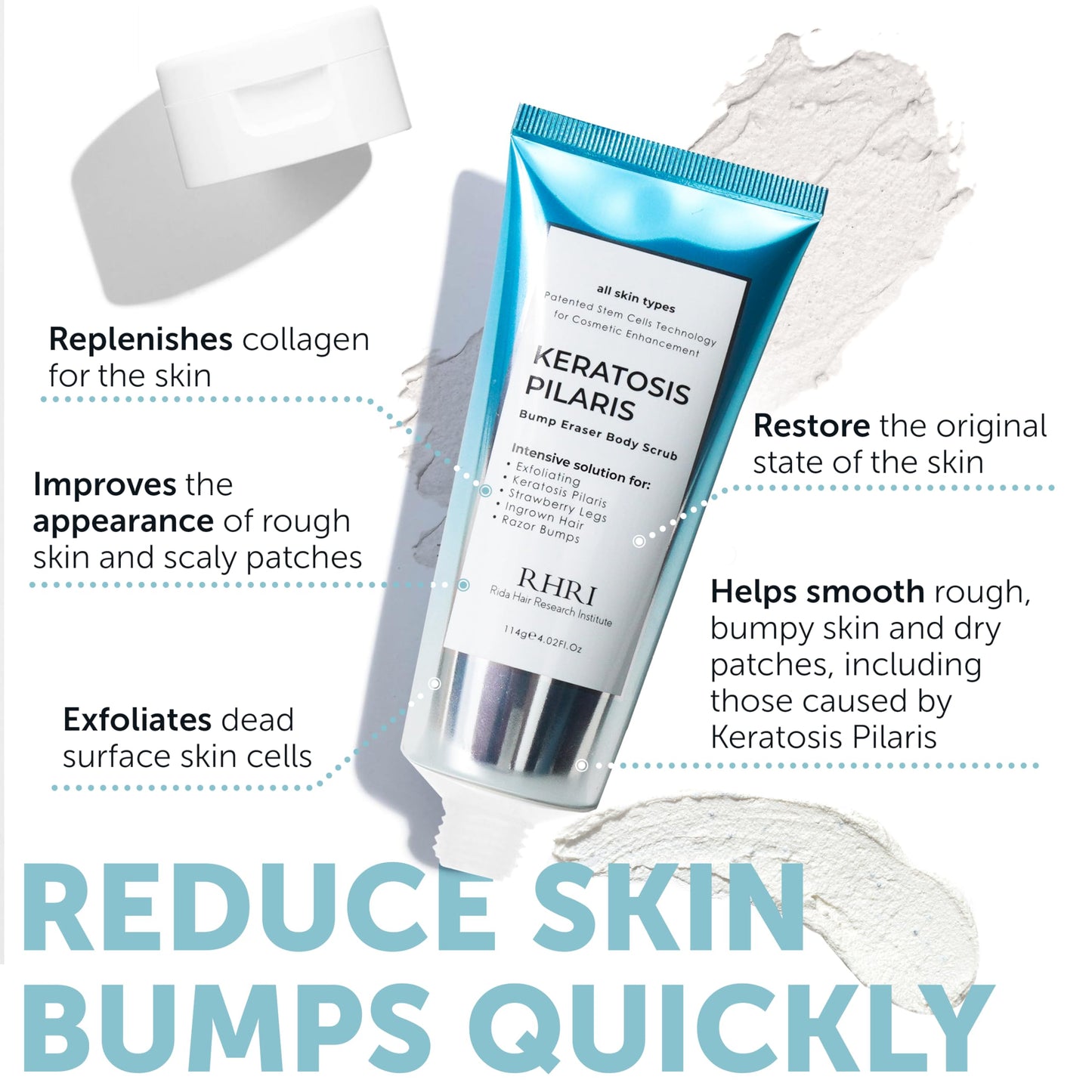 KP Bump Eraser Body Scrub with 10% AHA | Keratosis Pilaris Treatment | Bump Eraser Body Scrub | Clears Strawberry Legs | Soothes Redness, Dryness & Flaky Skin