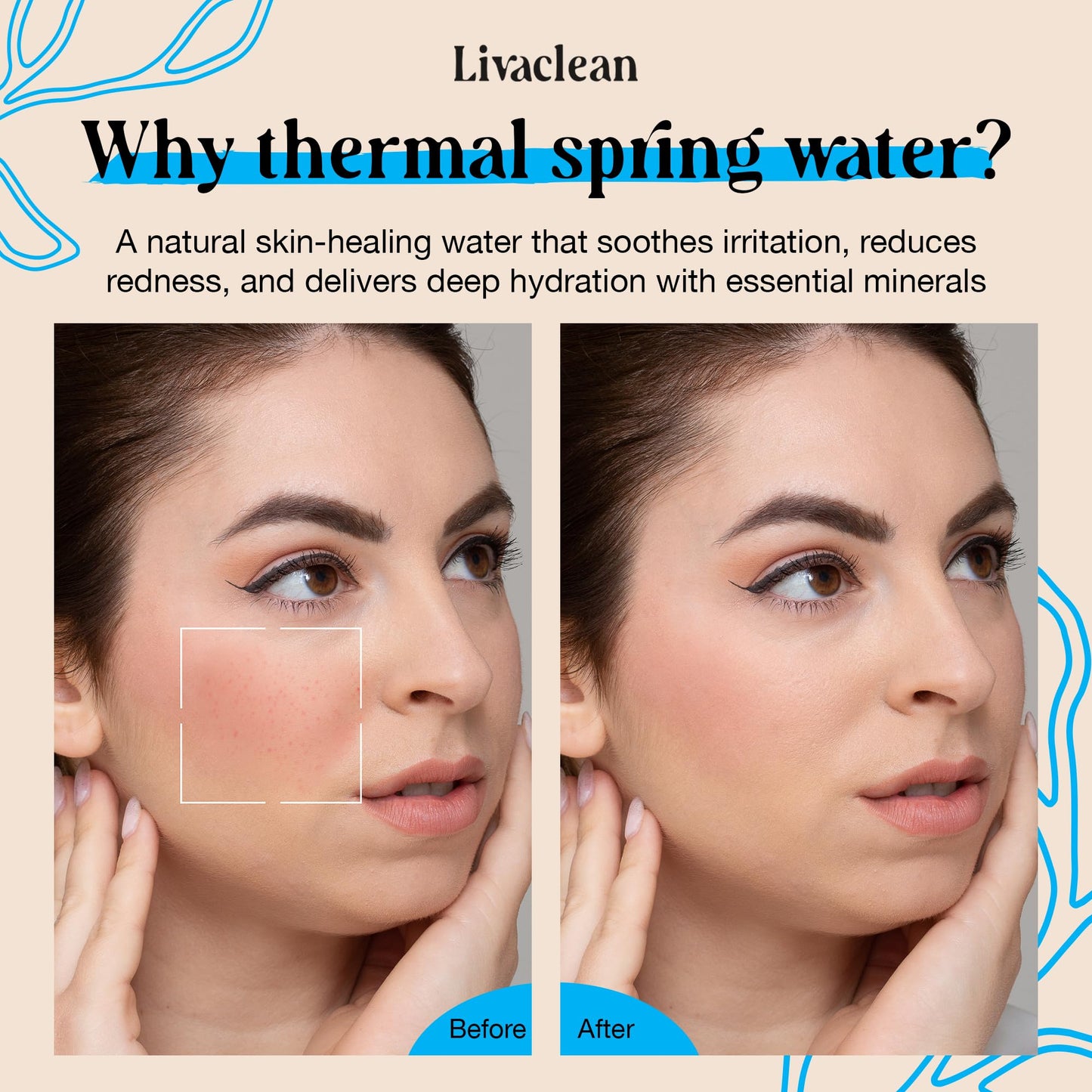 300ml + 50ml Thermal Spring Water Face Spray Mist Hydrating w/ Hyaluronic Acid & Aloe Vera - Hydrating Face Mist, Soothing & Calming, Mineral-Rich Skin Nourishment, Refreshing, 10 fl oz + 1.7 fl oz