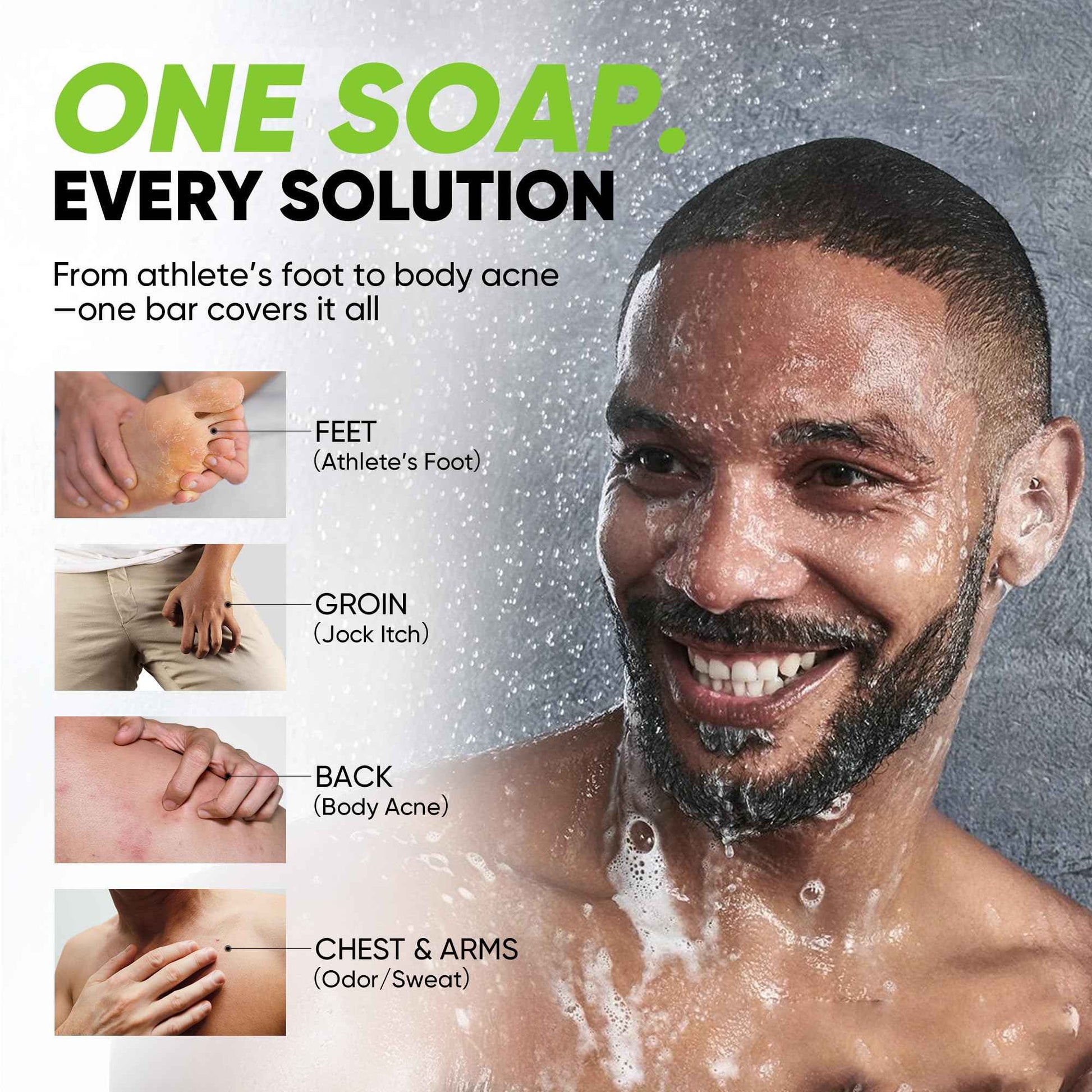 Roycederm Antifungal Soap for Active Skin – Medicated Bar for Athlete’s Foot, Jock Itch, Ringworm with Tea Tree Oil, Charcoal & Volcanic Ash