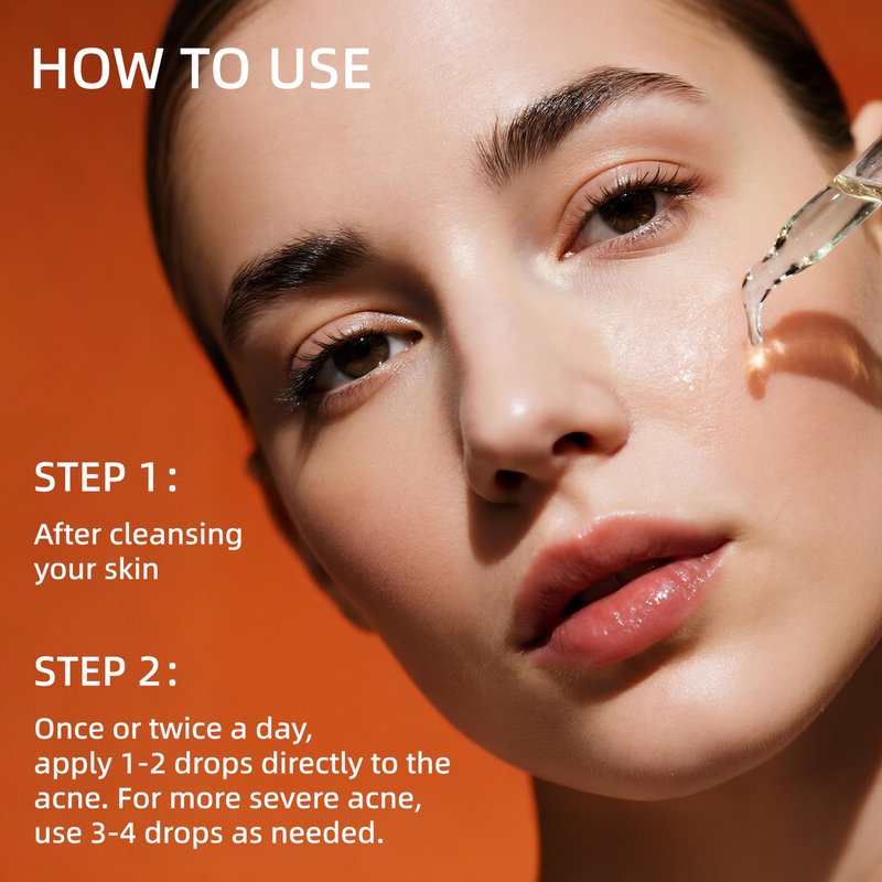 HKY Acne Serum, Salicylic Acid (BHA) + PHA + PAD, Redness Relief in 90 Mins, OTC Formula with Rice Ferment & Centella & Niacinamide, Pore Minimizer & Post-Acne Mark Treatment, Acne-Prone Skin [20ml]