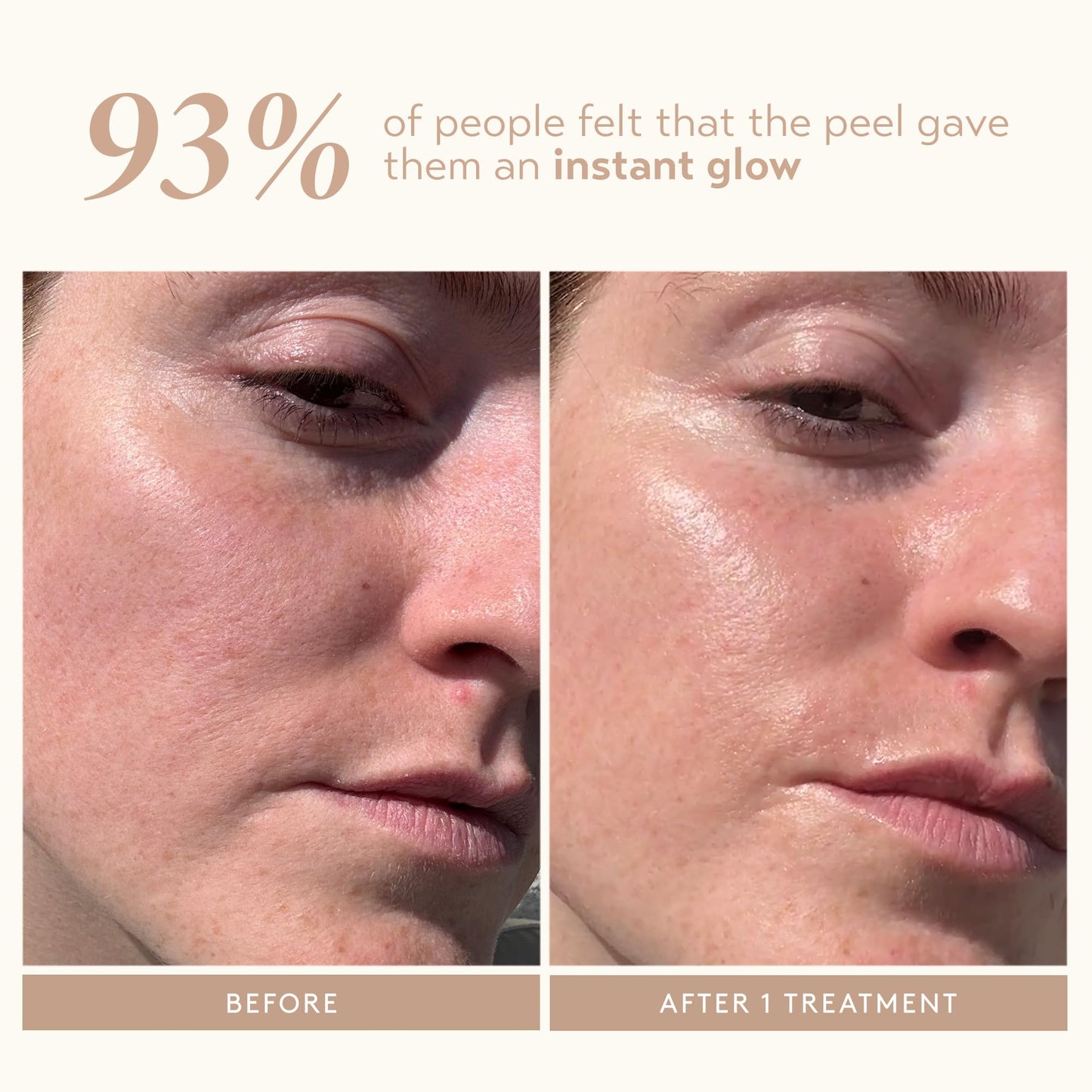 SHANI DARDEN SKIN CARE Triple Acid Peel, 2-Step Exfoliating Face Peel Treatment (2 Peels) with Mandelic, Lactic/Glycolic Acids, and Kaolin Clay Neutralizing Mask (0.5 fl oz) & Brush