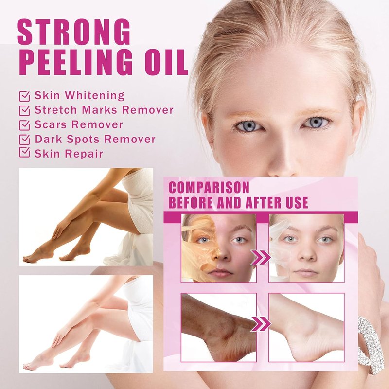 Yellow Peeling Oil - Exfoliating Body Oil for Dark Skin | 330ML/10.98Fl Oz