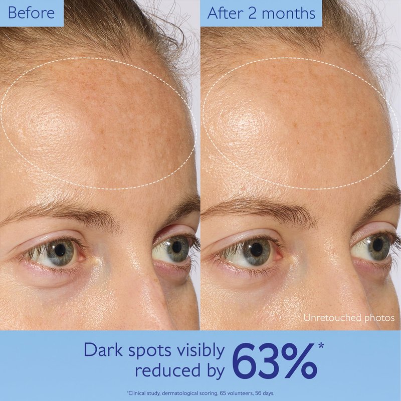 Caudalie Vinoperfect Brightening Dark Spot Serum Vitamin C Alternative - 62x More Effective than Vitamin C with Viniferine for a Visibly Brighter Even Complexion, 30 mL