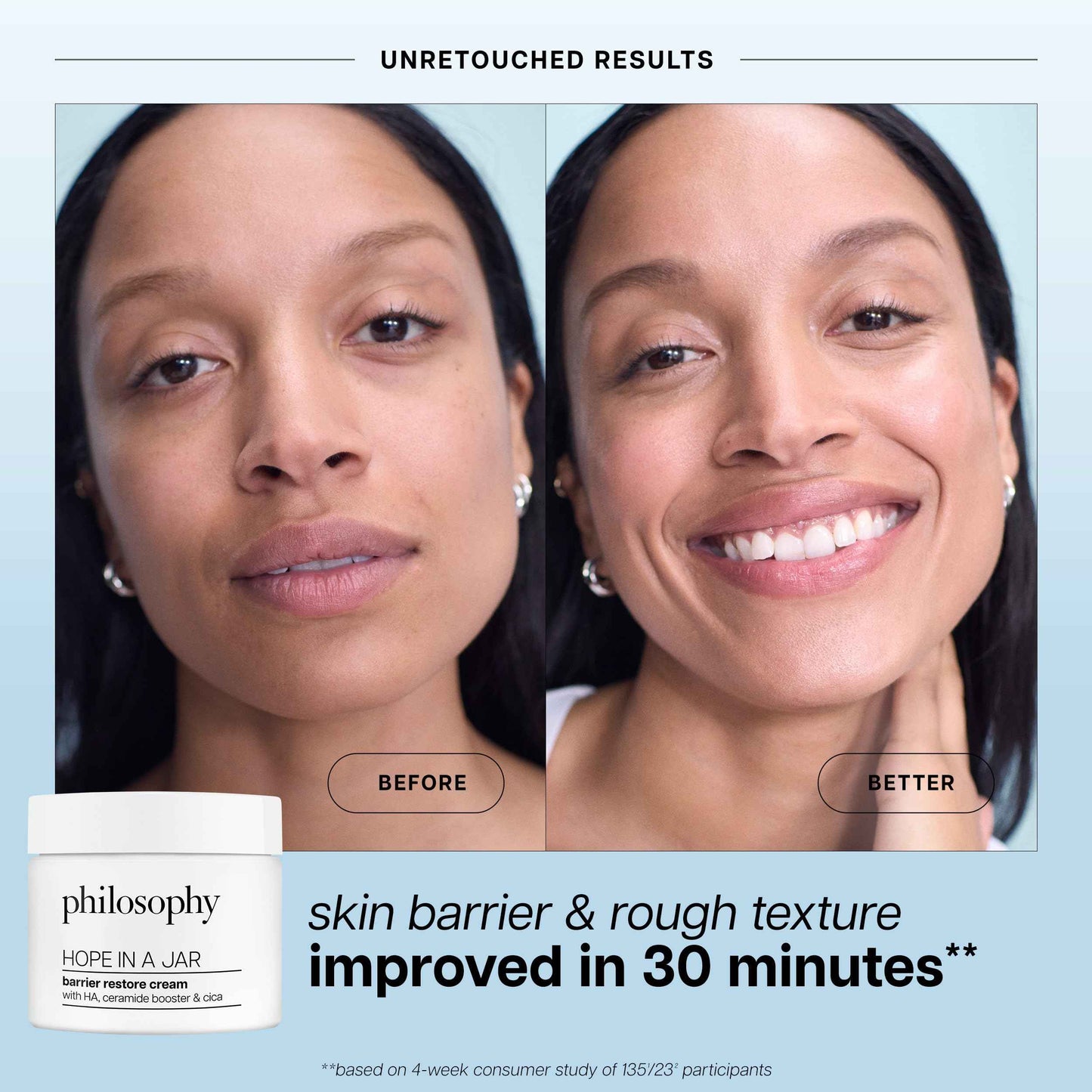 philosophy hope in a jar barrier restore cream – with ha+ complex, cica & ceramides – intensely hydrating moisturizer for dry, sensitive skin – repairs & soothes