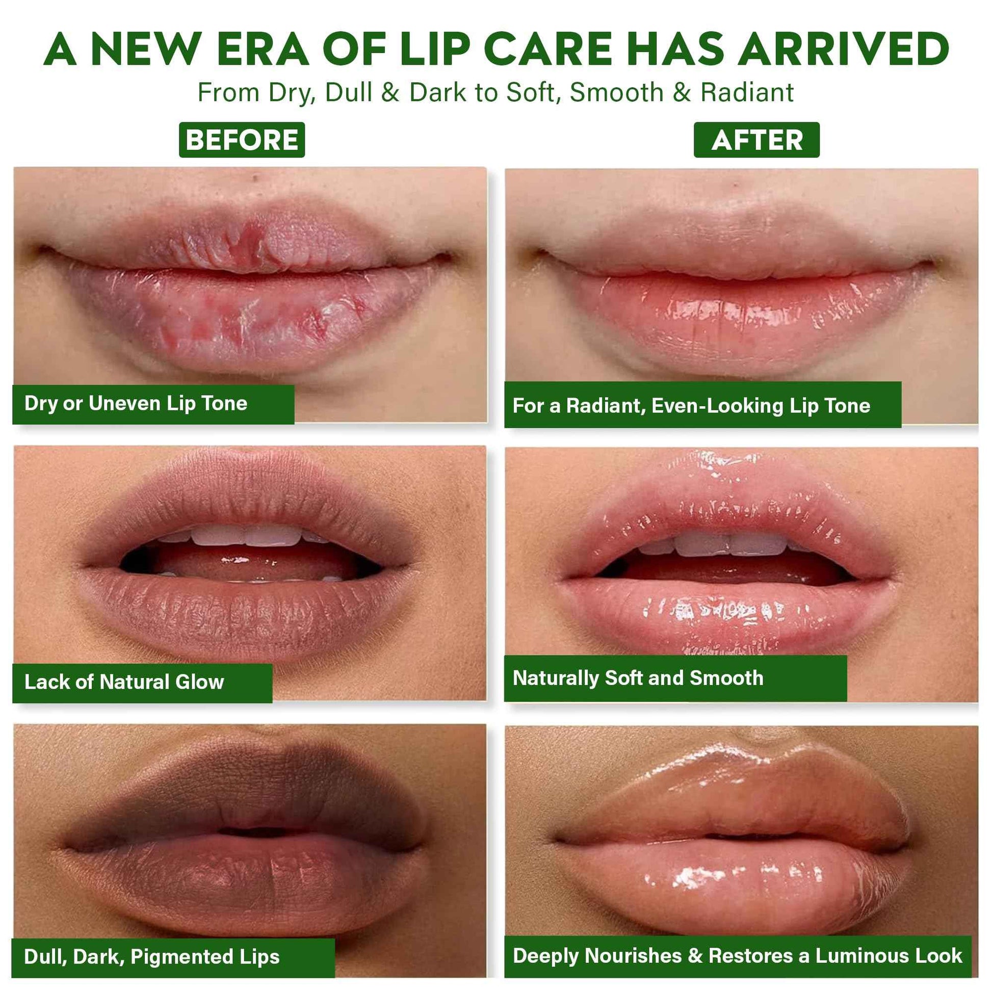 AUREVIA Vegan Lip Brightening Balm – Ayurvedic Lip Care for Dark & Smoker Lips | Deeply Hydrating, Moisturizing & Nourishing with Rich Antioxidants – Clean Beauty Plant-Based Formula