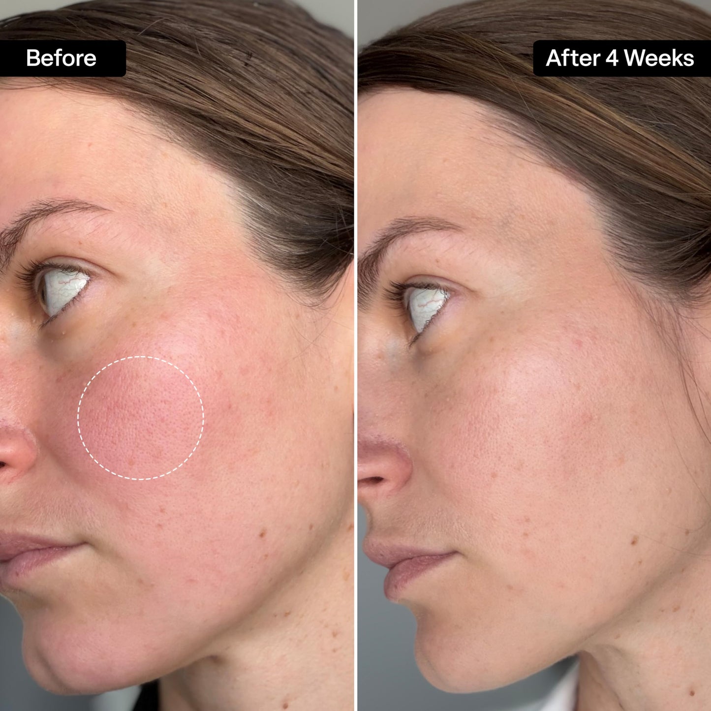 QRxLabs Squalane Oil for Face - Hydrating Face Oil for Women with Vitamin E - Dermaplaning & Gua Sha Massage - Moisturizer for Oily Skin - Unscented, 2 Fl Oz
