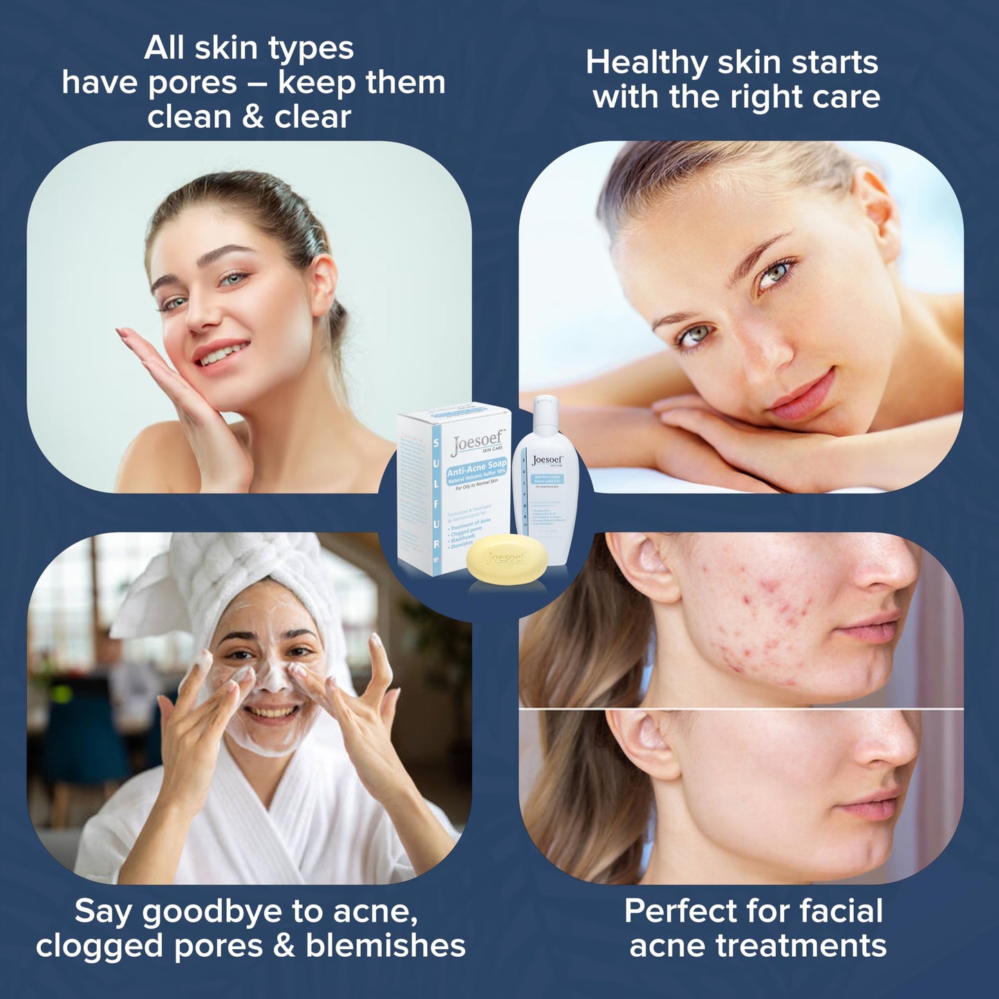 JOESOEF SKIN CARE Sulfur Soap for Acne Pharmaceutical Grade Dermatologists Approved for Acne Rosacea. Sulfur Acne Treatment for Skin Care Daily Routine. (2pack)