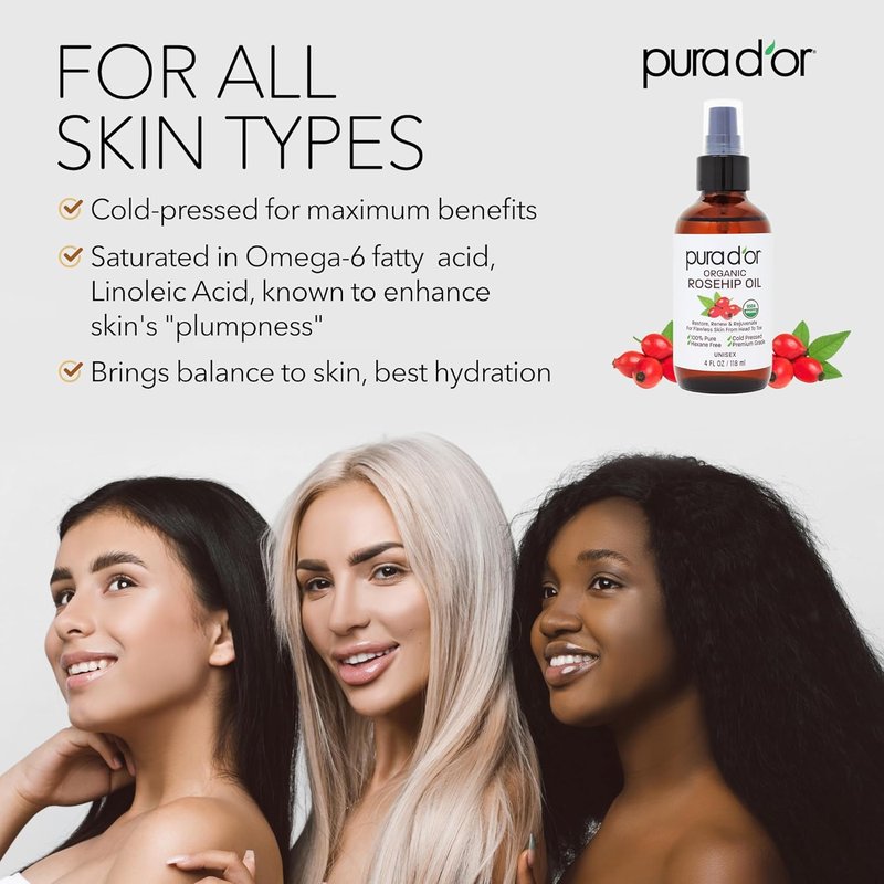 Organic Rosehip Seed Oil Hair Relaxer - 100% Pure Cold Pressed | Anti-Aging & Scar Treatment, 12 Oz