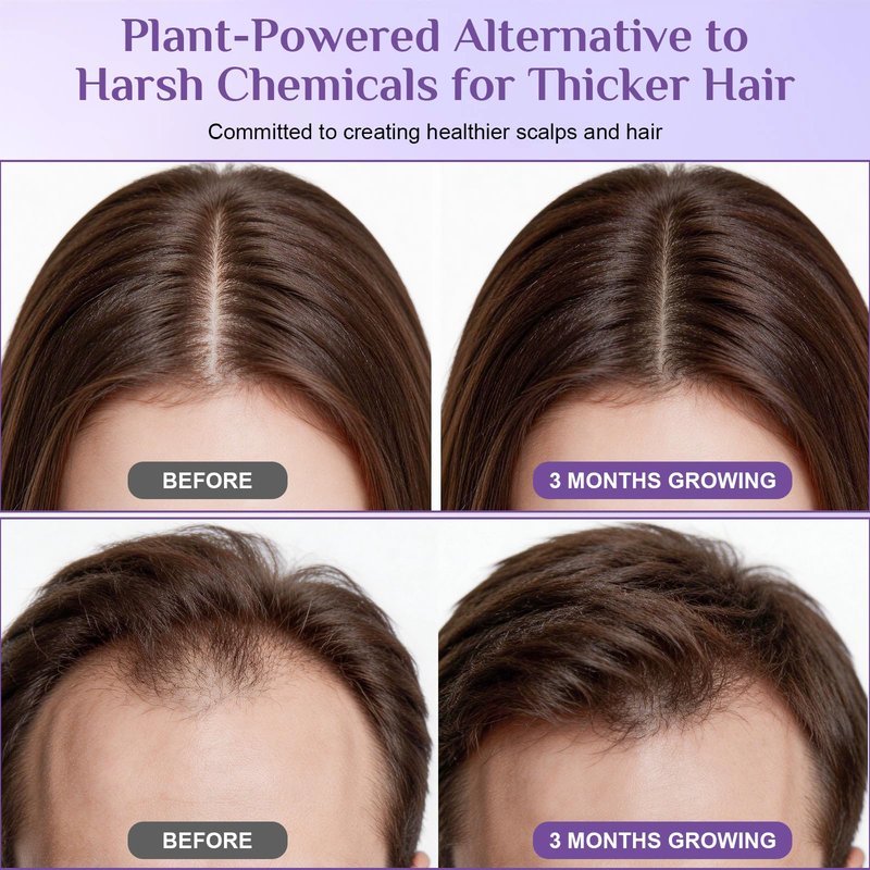 Rosemary Hair Growth Serum Roll-On | Rosemary Oil, Biotin, Anagain, Caffeine, Niacinamide | Fleird™ X7 Technology – Thinning Hair & Hair Fall – Thicker, Fuller Hair for Women & Men,1 Fl Oz (Pack of 2)