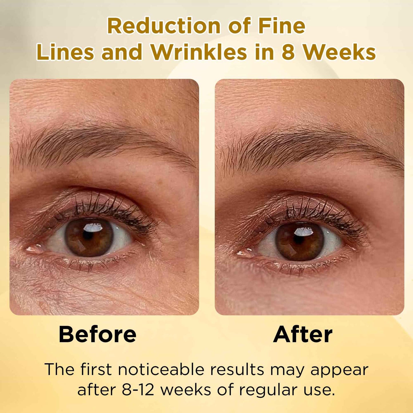 LADY NADA Retinol Eye Serum – Anti-Aging Night Treatment with Collagen, Vitamin E & Natural Extracts – Smooths Fine Lines, Deeply Hydrates, Long-Lasting Effect – For All Skin Types – 1.0 fl oz